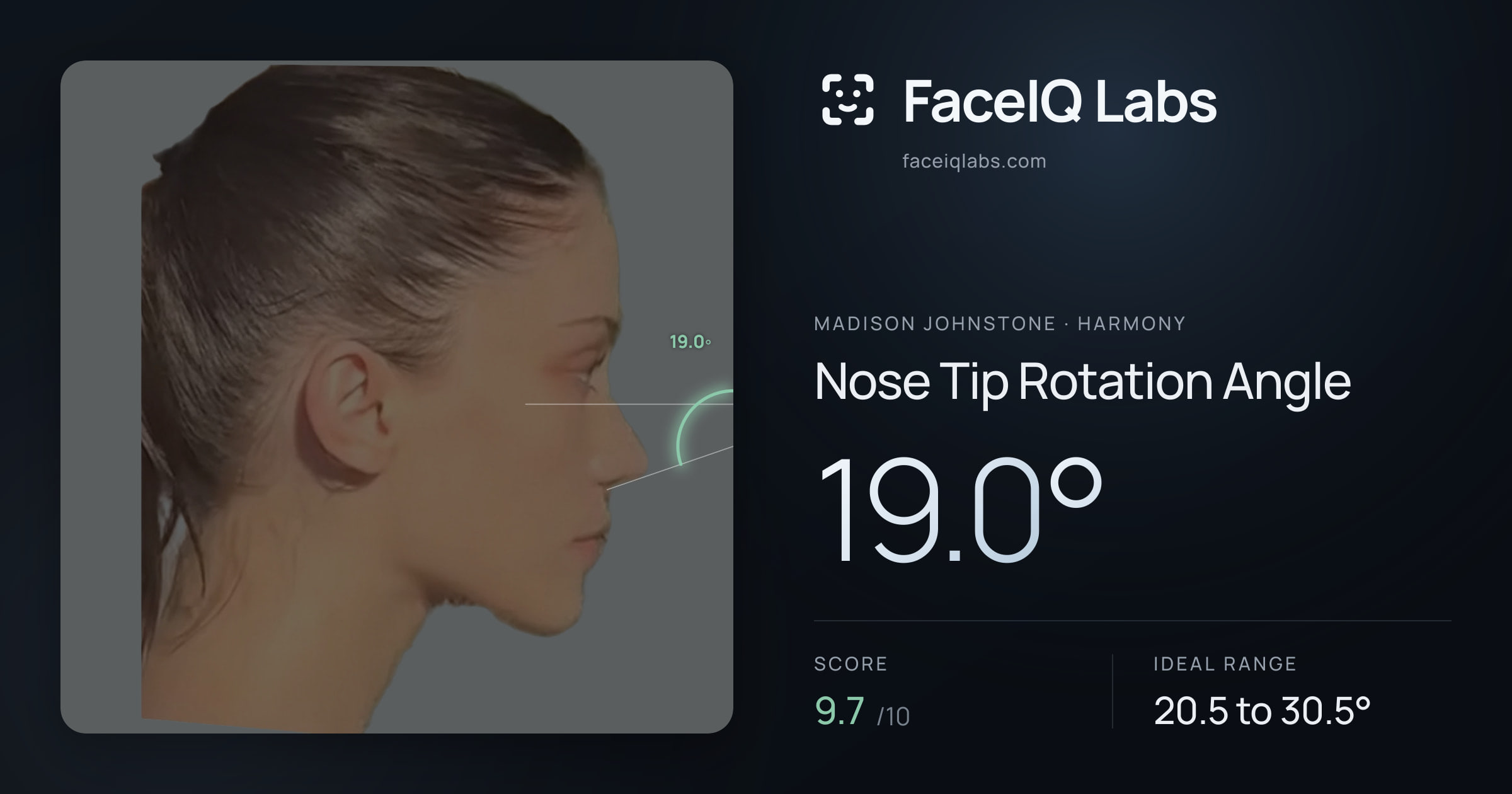 Madison Johnstone Nose Tip Rotation Angle: 19.0°, drawn on the photo