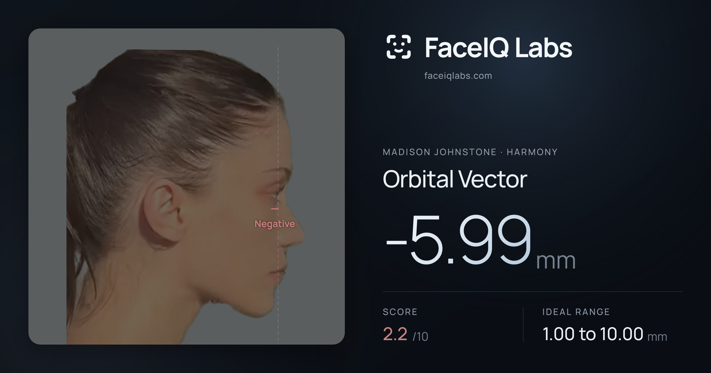 Madison Johnstone Orbital Vector: -5.99mm, drawn on the photo