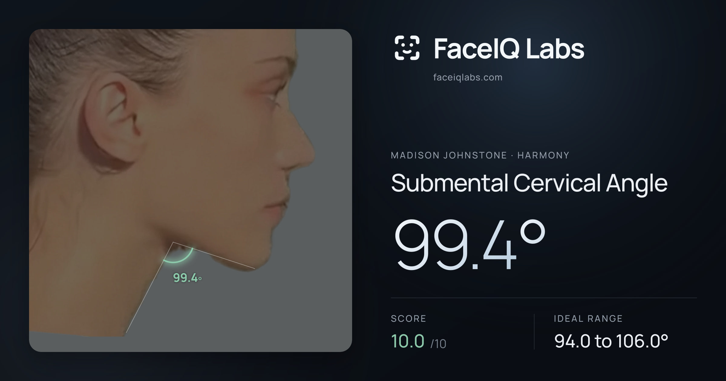 Madison Johnstone Submental Cervical Angle: 99.4°, drawn on the photo