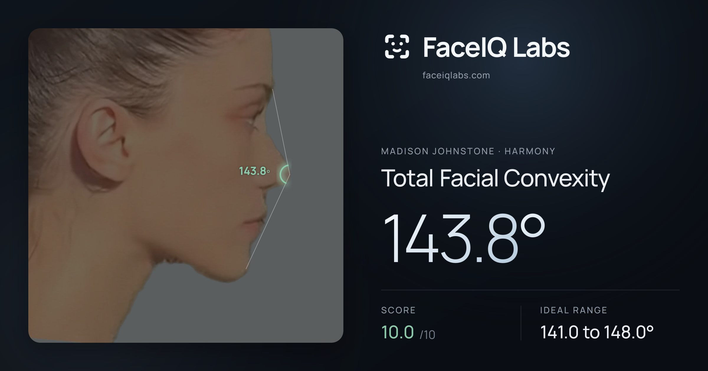 Madison Johnstone Total Facial Convexity: 143.8°, drawn on the photo