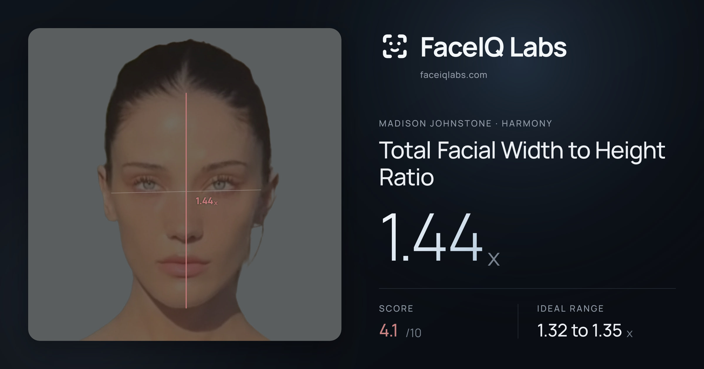 Madison Johnstone Total Facial Width to Height Ratio: 1.44x, drawn on the photo