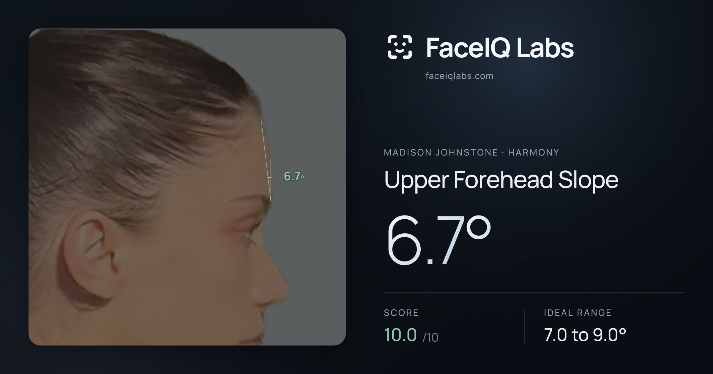 Madison Johnstone Upper Forehead Slope: 6.7°, drawn on the photo