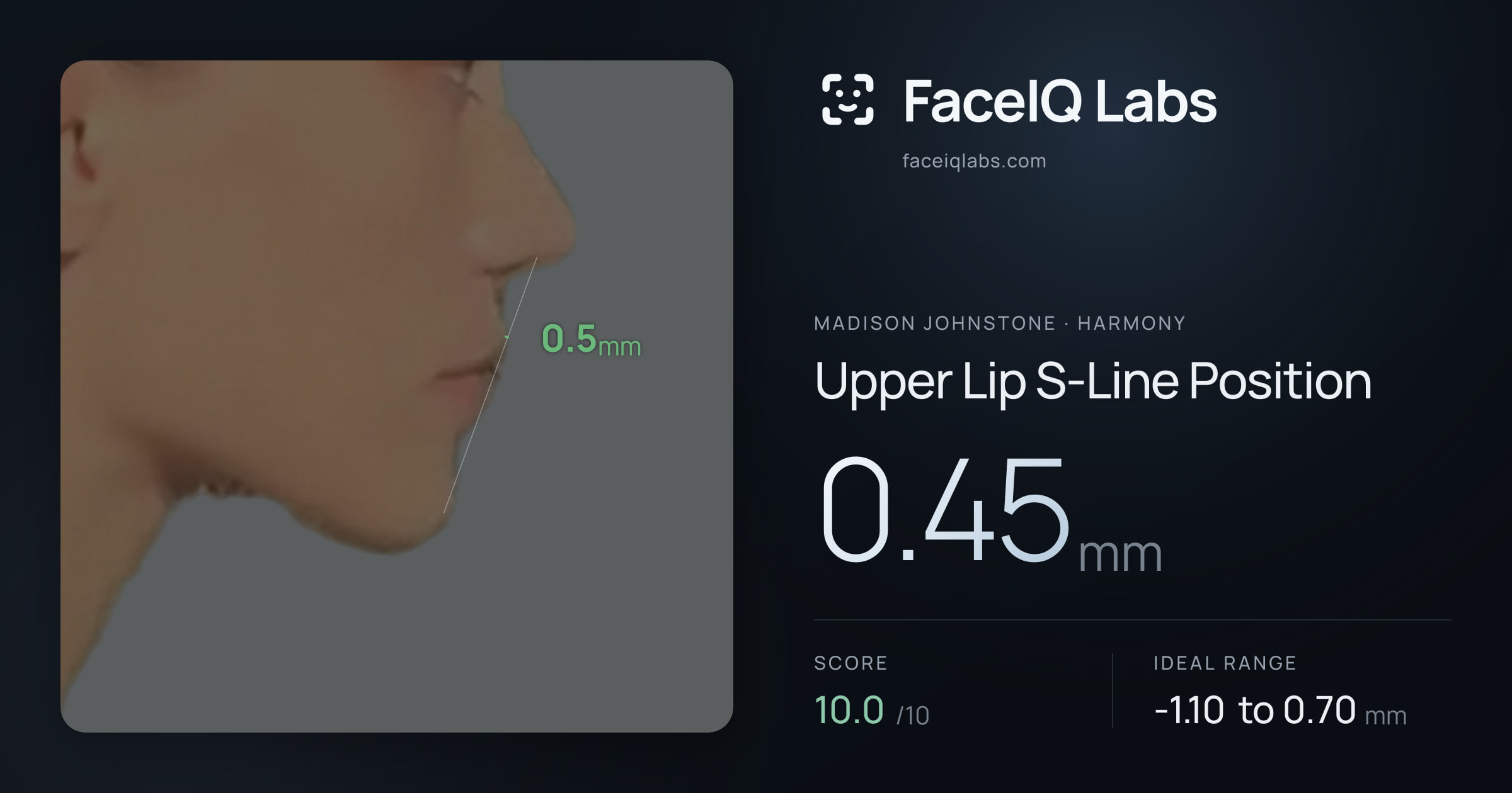 Madison Johnstone Upper Lip S-Line Position: 0.45mm, drawn on the photo