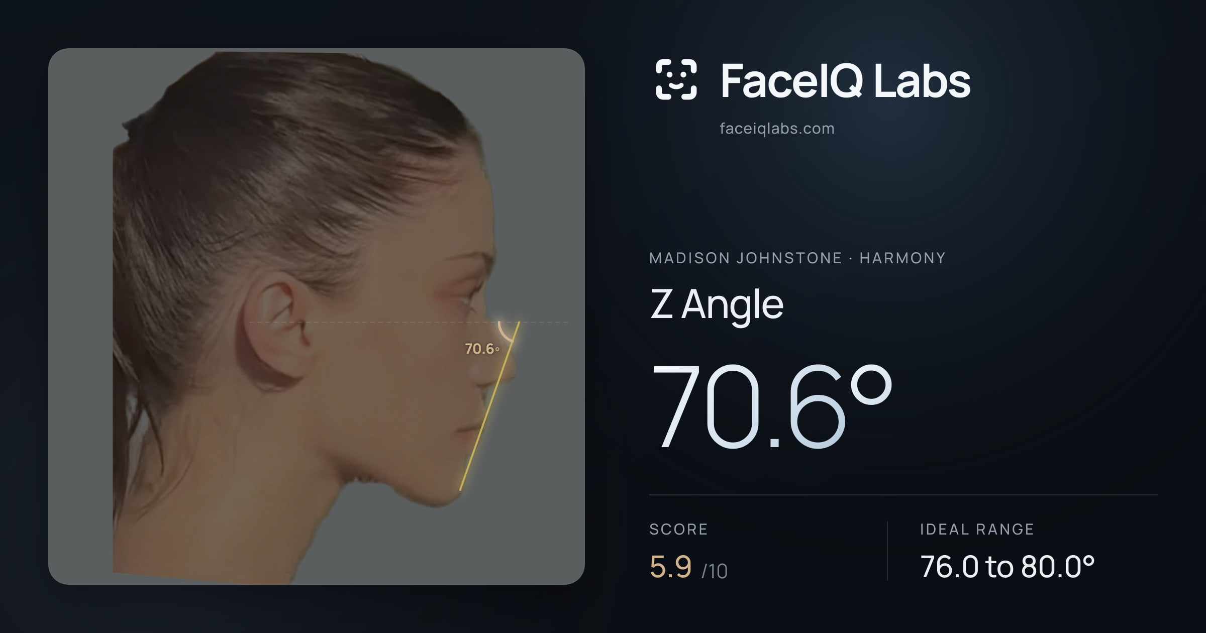 Madison Johnstone Z Angle: 70.6°, drawn on the photo