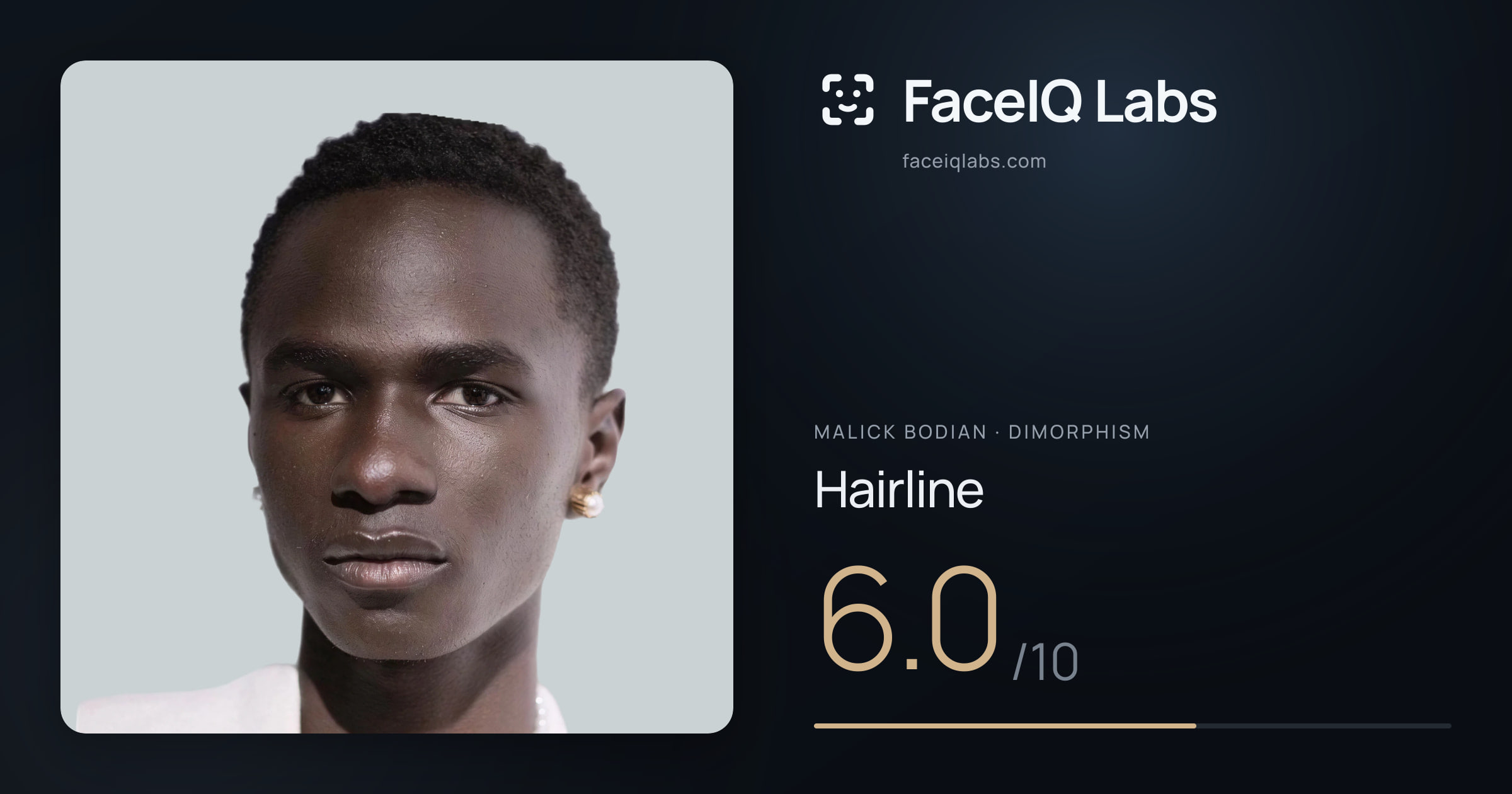 Malick Bodian Hairline: 6.0/10, drawn on the photo