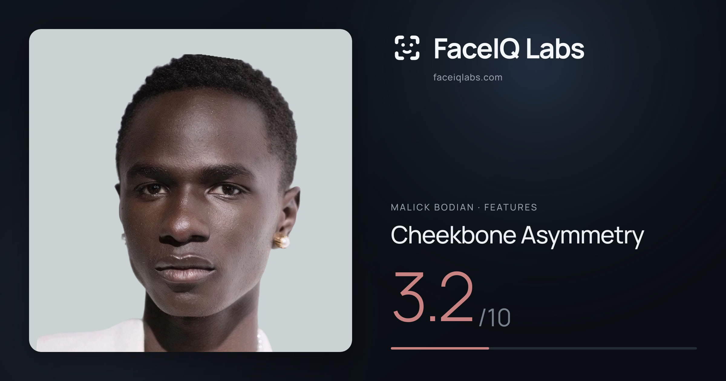 Malick Bodian Cheekbone Asymmetry: 3.2/10, drawn on the photo