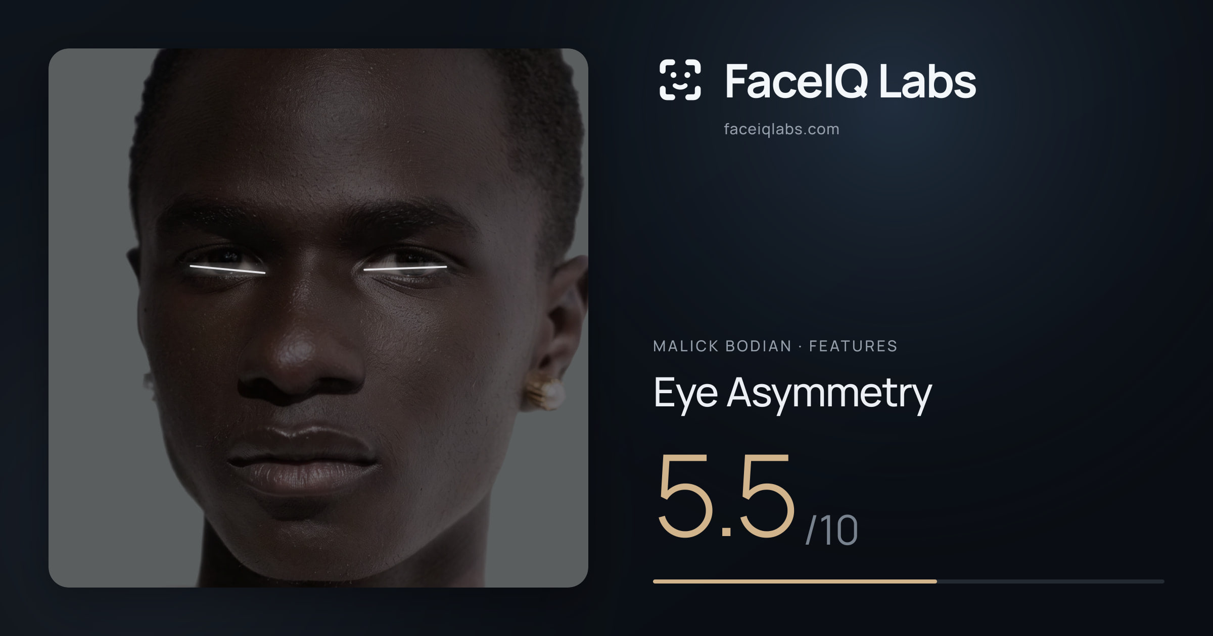Malick Bodian Eye Asymmetry: 5.5/10, drawn on the photo