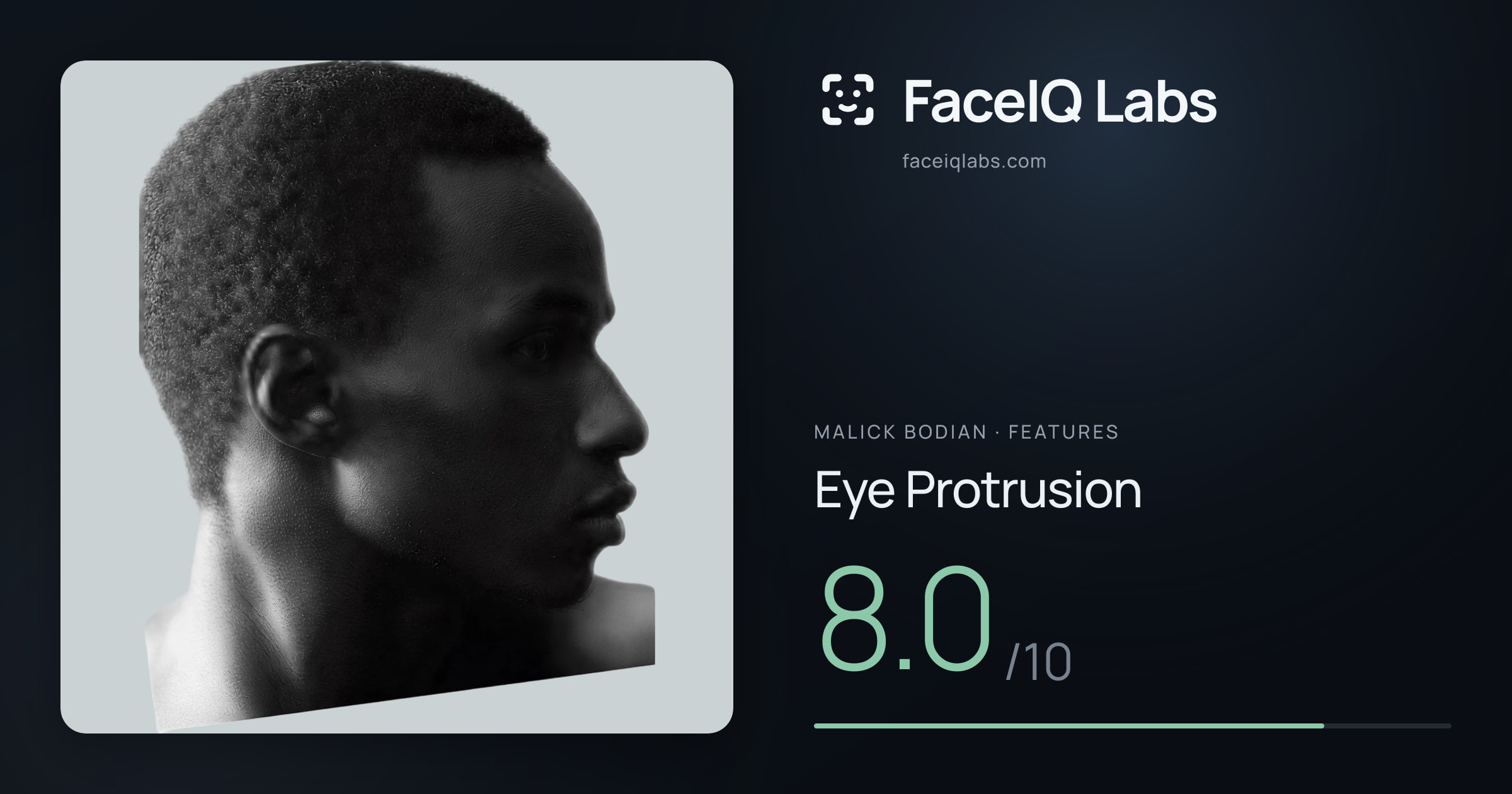 Malick Bodian Eye Protrusion: 8.0/10, drawn on the photo