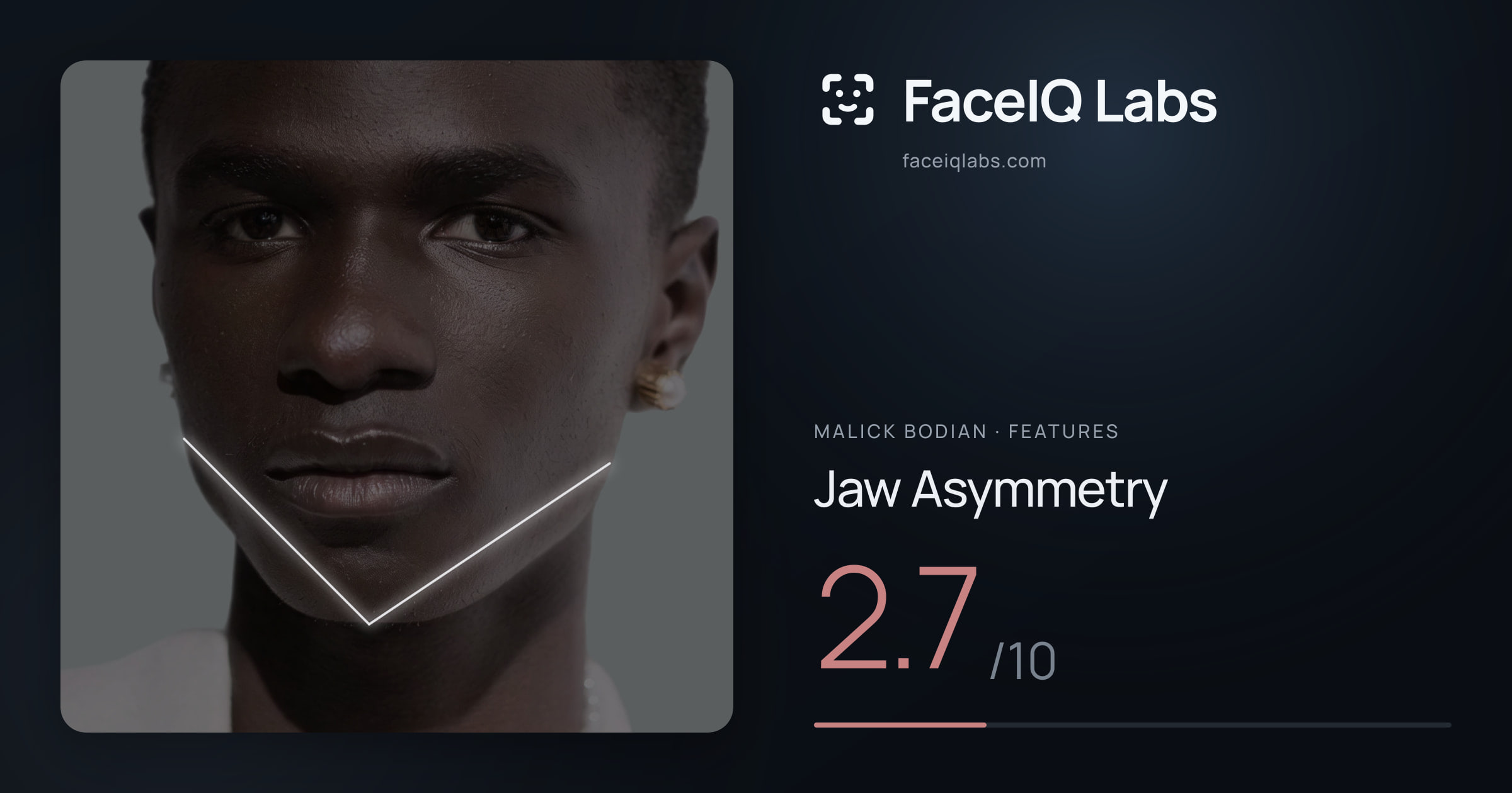 Malick Bodian Jaw Asymmetry: 2.7/10, drawn on the photo
