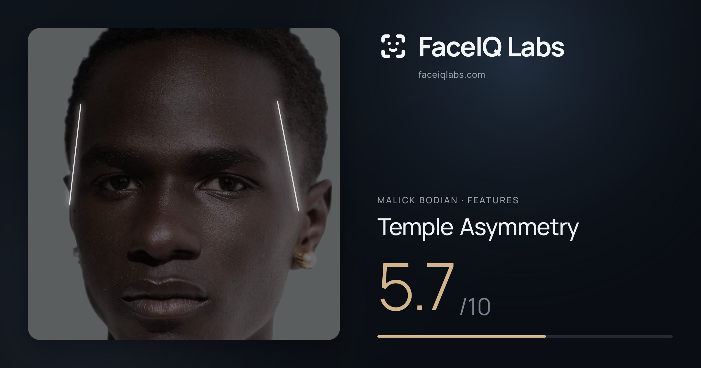 Malick Bodian Temple Asymmetry: 5.7/10, drawn on the photo
