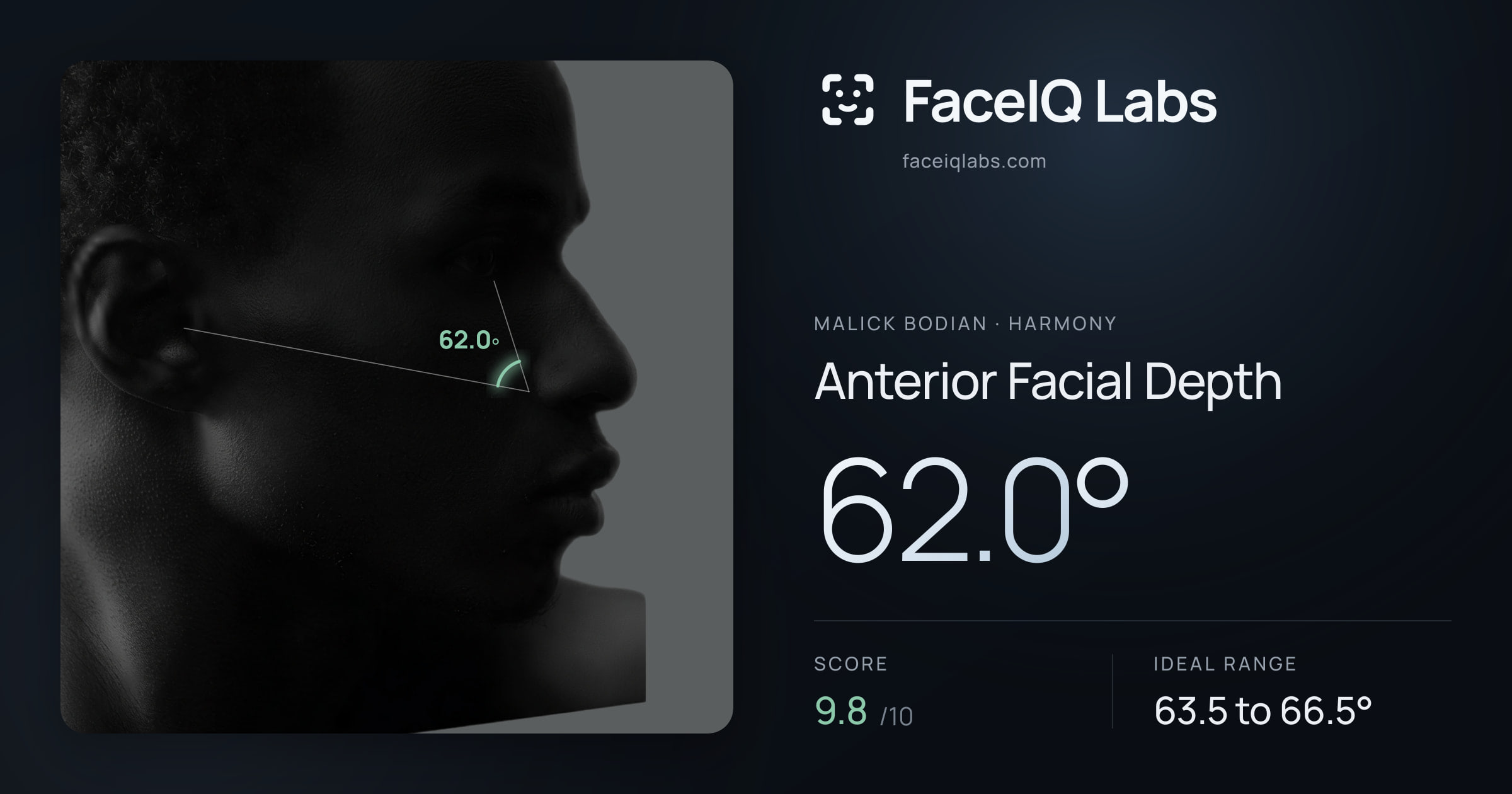 Malick Bodian Anterior Facial Depth: 62.0°, drawn on the photo