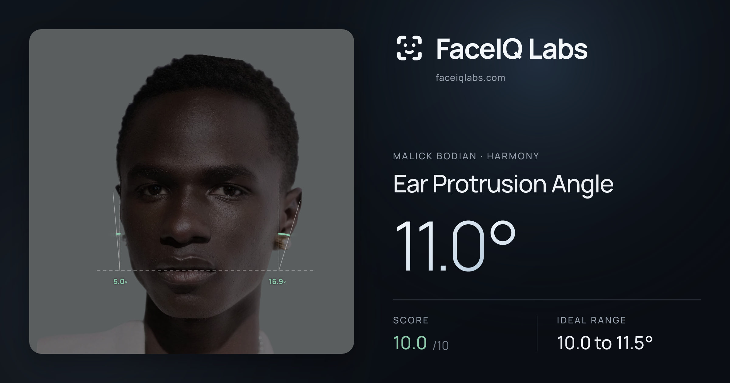 Malick Bodian Ear Protrusion Angle: 11.0°, drawn on the photo