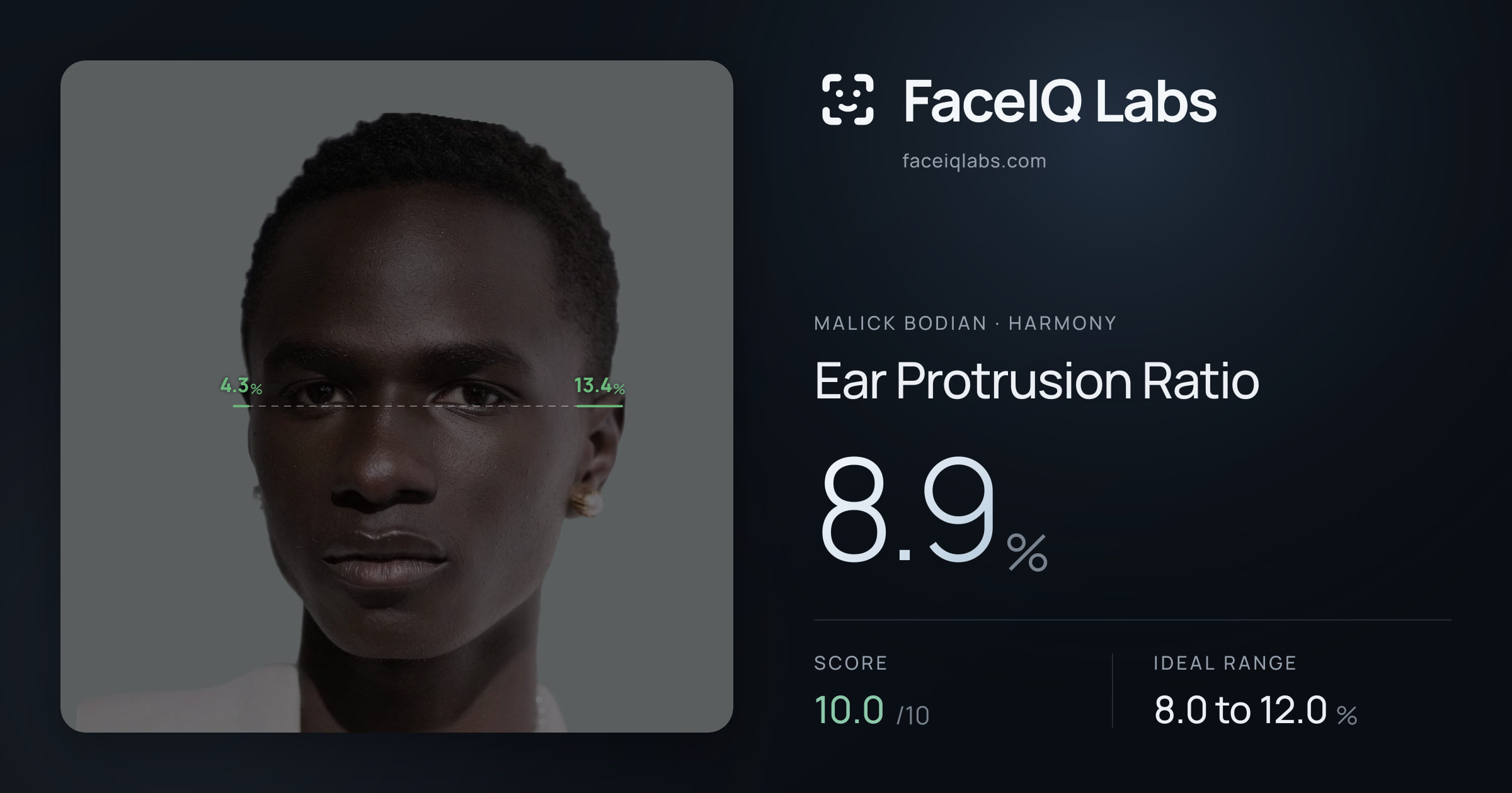 Malick Bodian Ear Protrusion Ratio: 8.9%, drawn on the photo