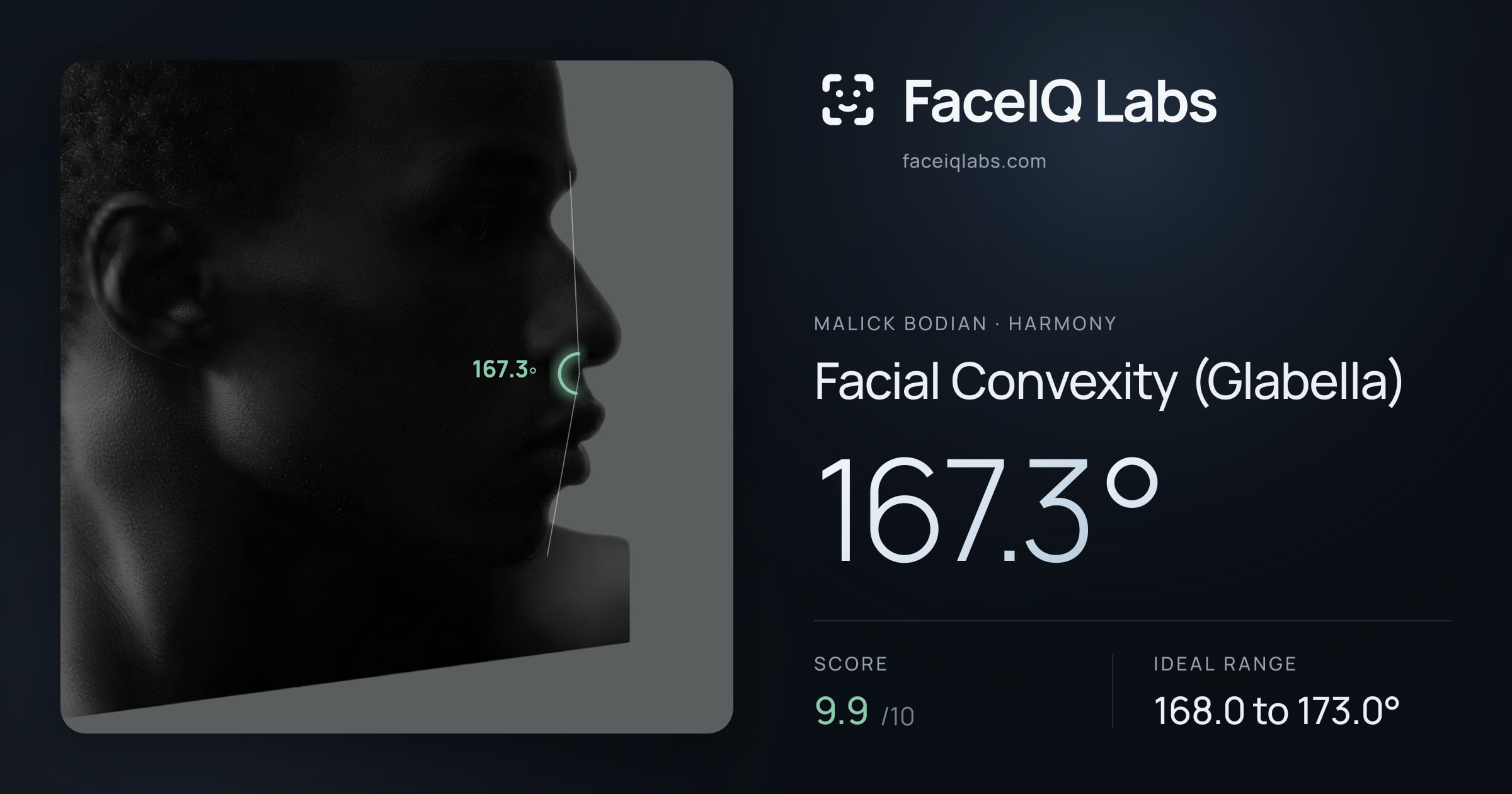 Malick Bodian Facial Convexity (Glabella): 167.3°, drawn on the photo