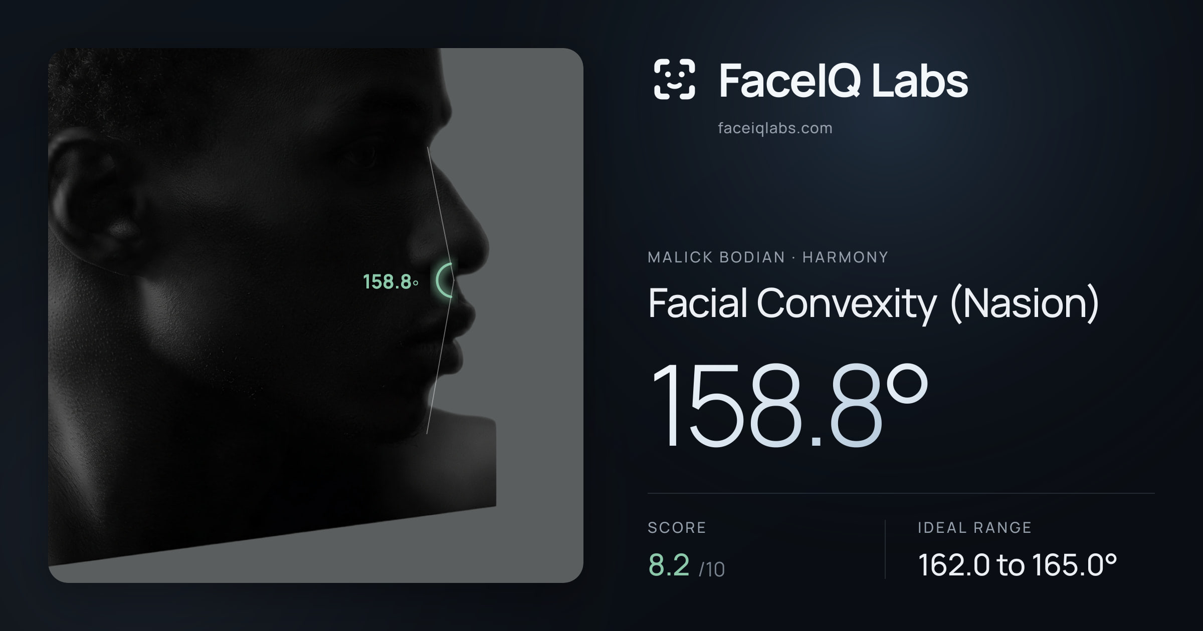 Malick Bodian Facial Convexity (Nasion): 158.8°, drawn on the photo