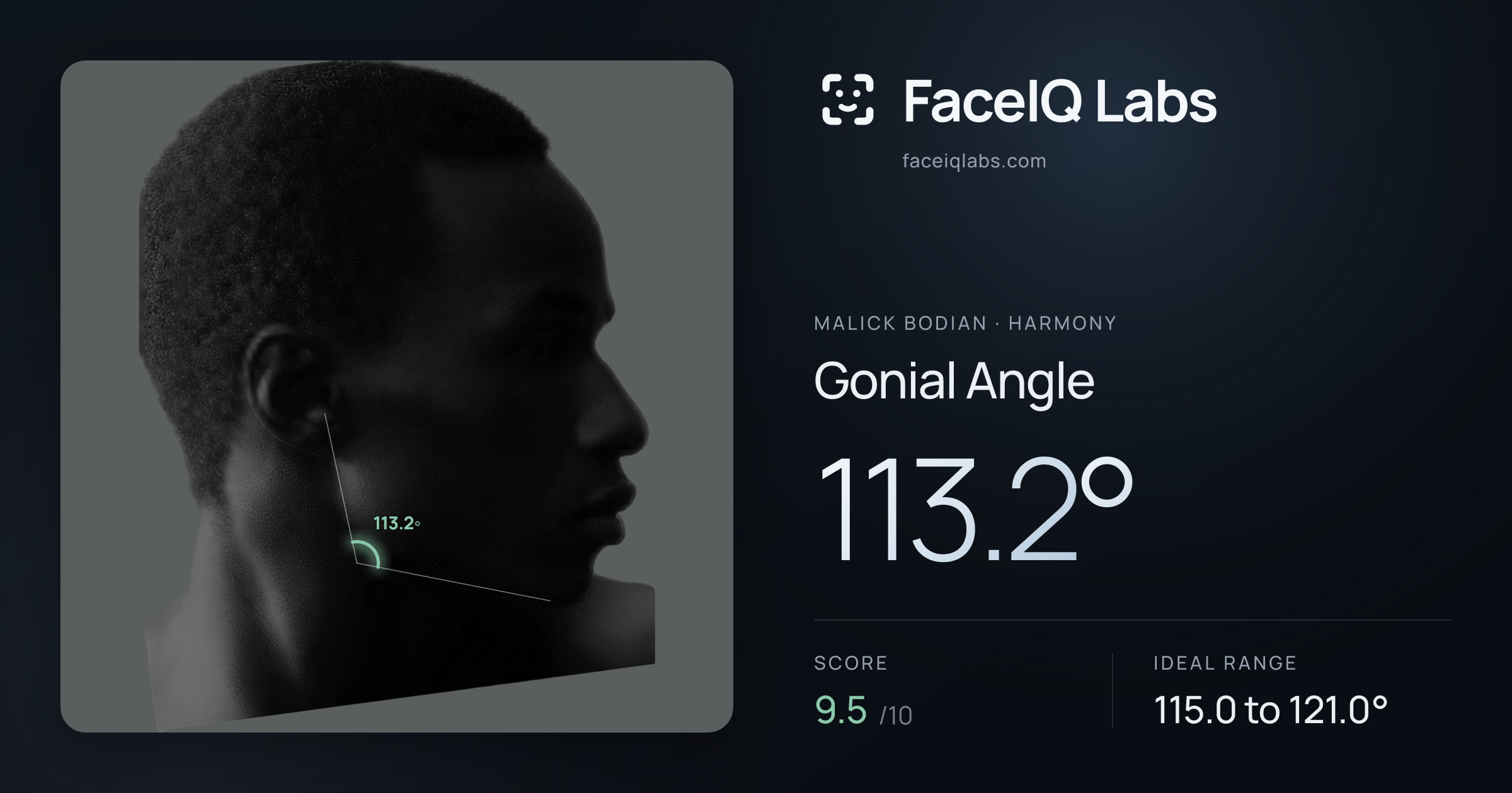 Malick Bodian Gonial Angle: 113.2°, drawn on the photo
