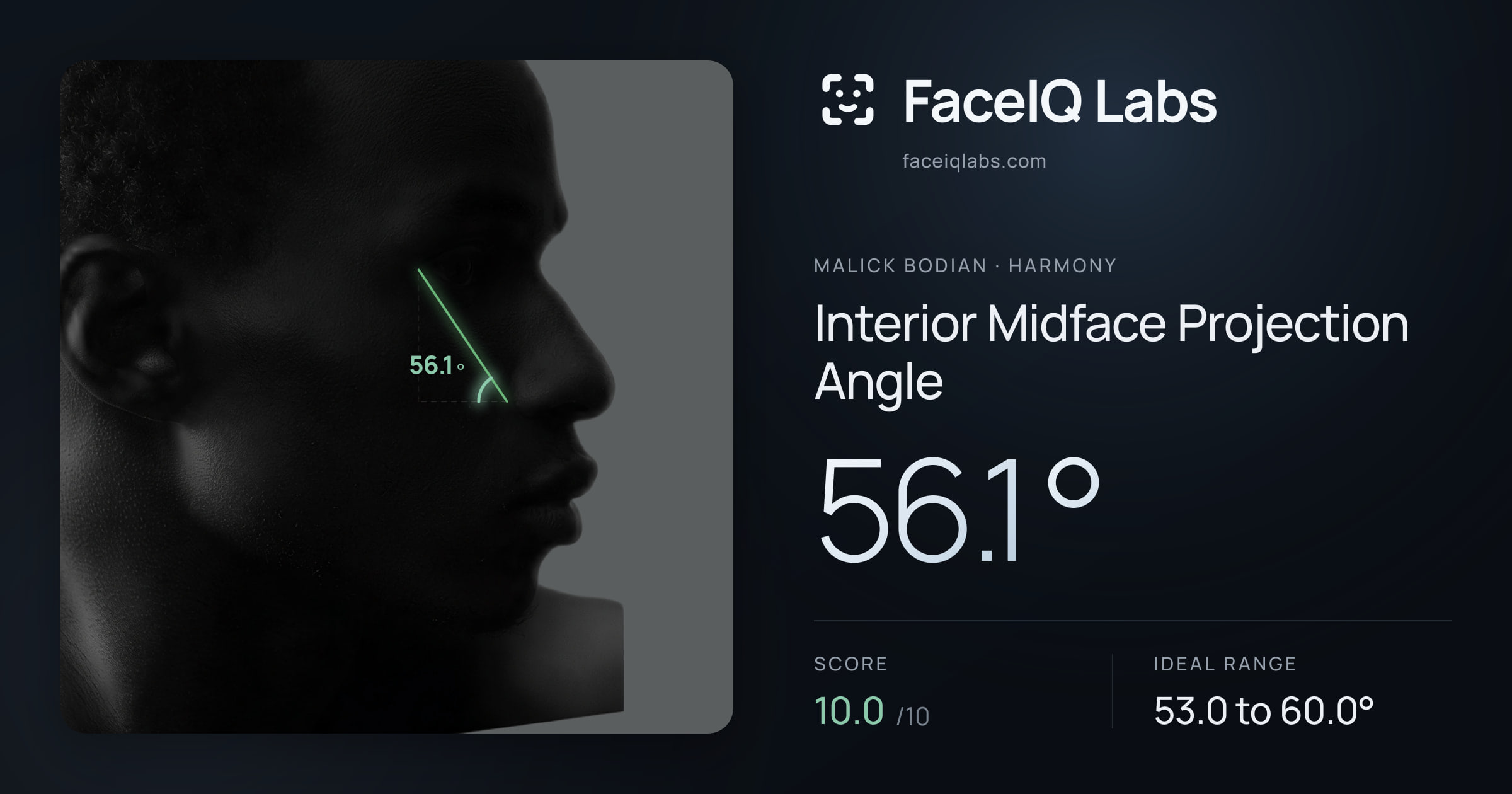 Malick Bodian Interior Midface Projection Angle: 56.1°, drawn on the photo