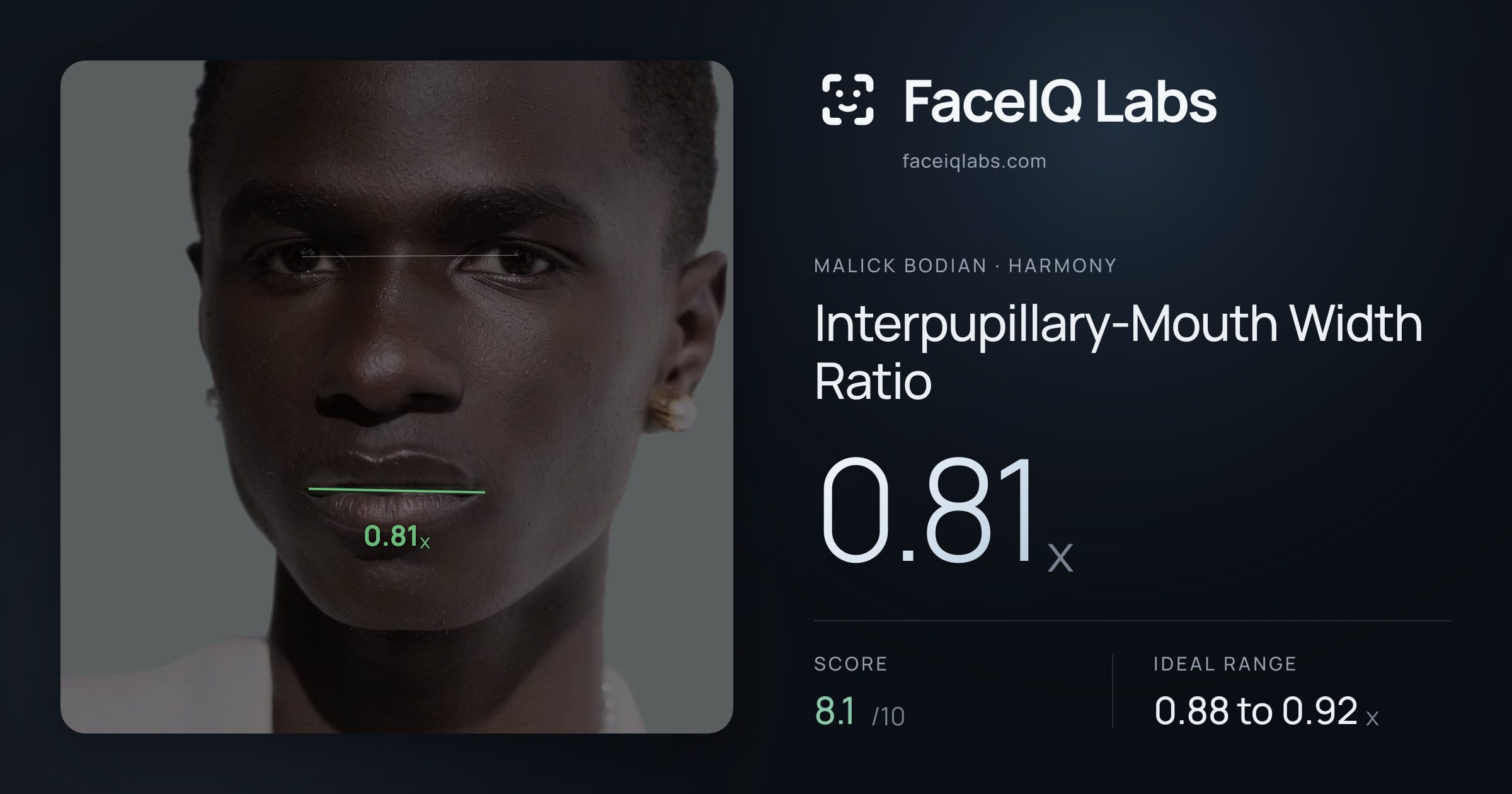 Malick Bodian Interpupillary-Mouth Width Ratio: 0.81x, drawn on the photo
