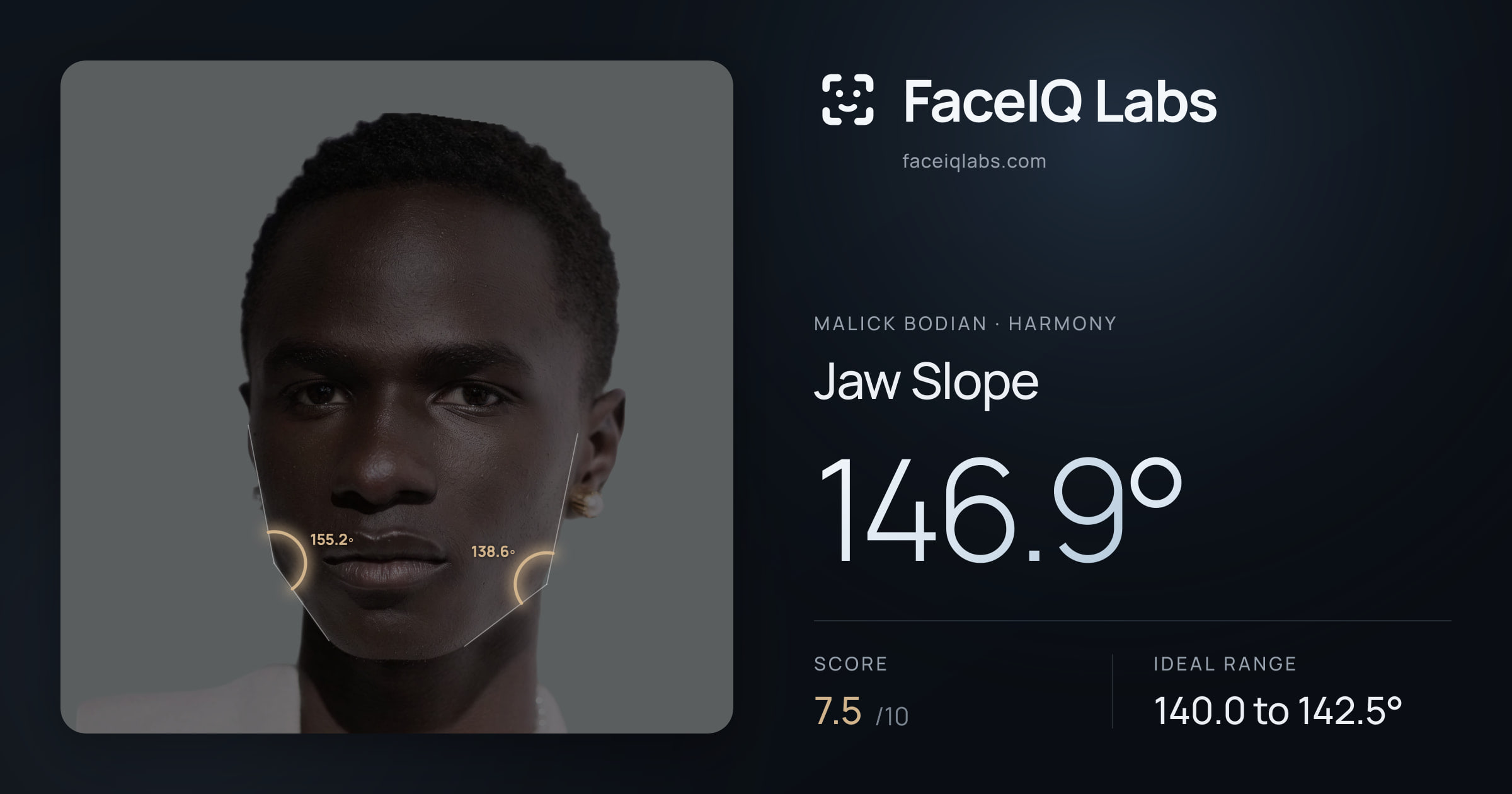Malick Bodian Jaw Slope: 146.9°, drawn on the photo