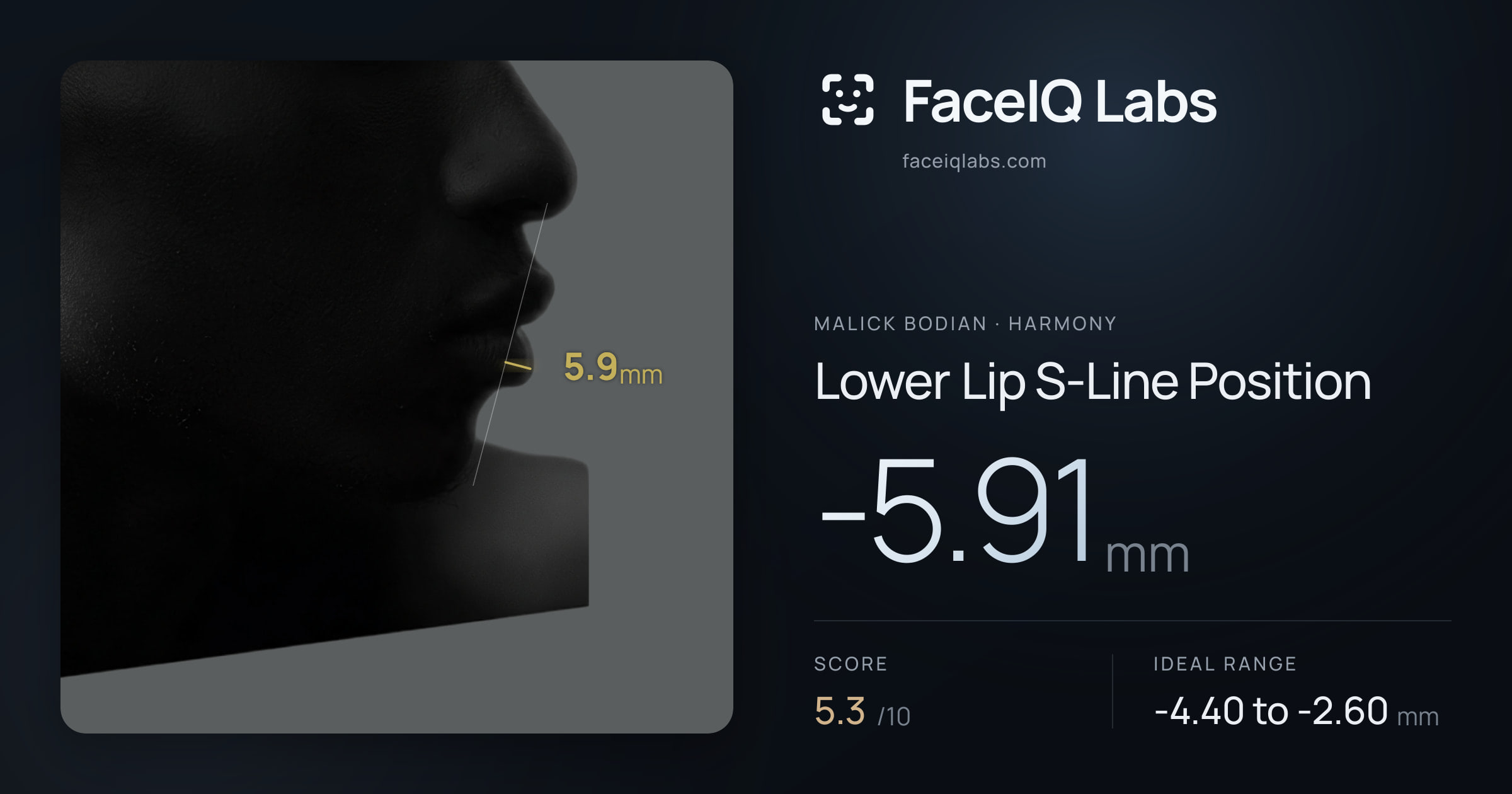 Malick Bodian Lower Lip S-Line Position: -5.91mm, drawn on the photo
