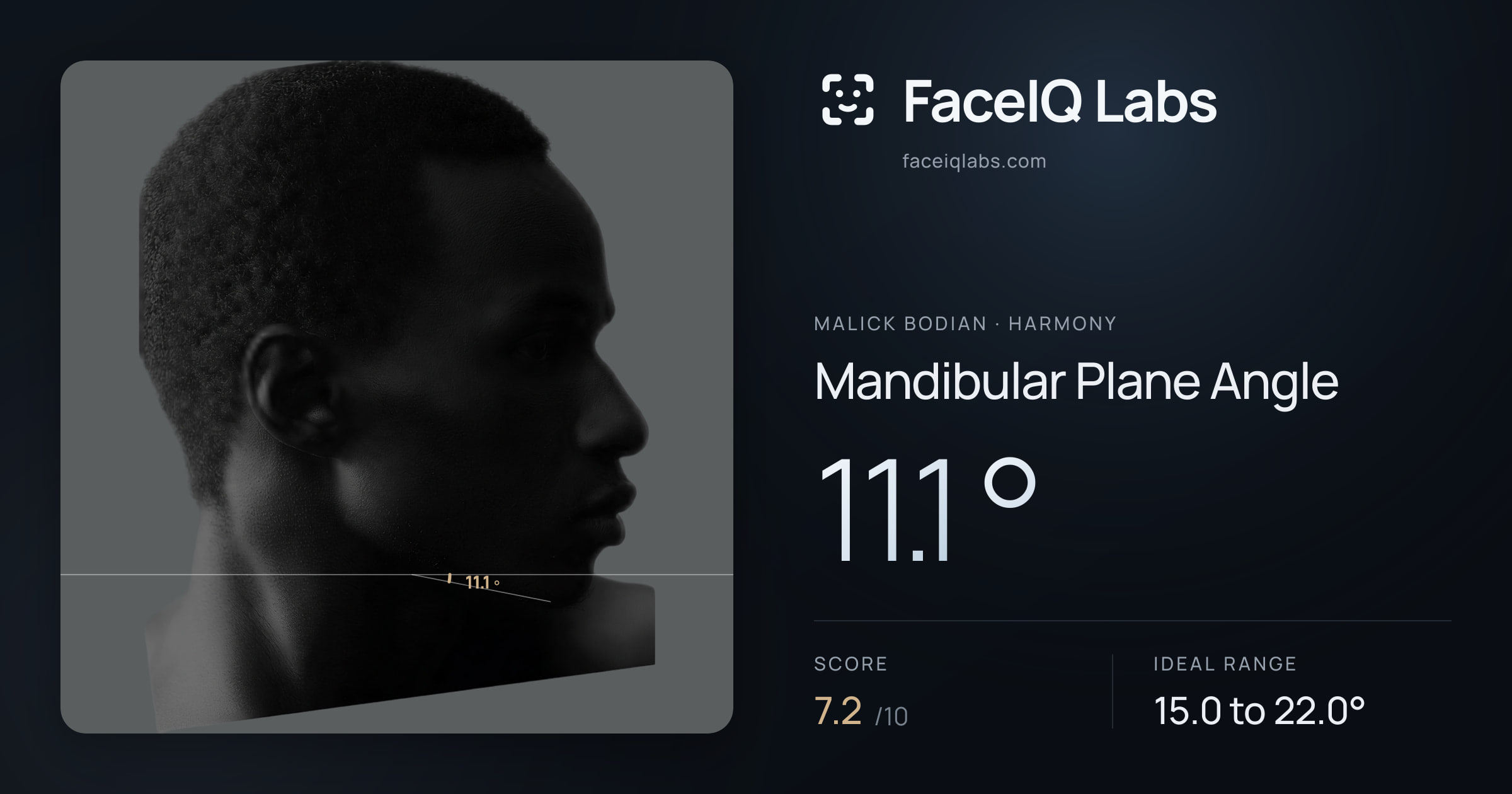 Malick Bodian Mandibular Plane Angle: 11.1°, drawn on the photo