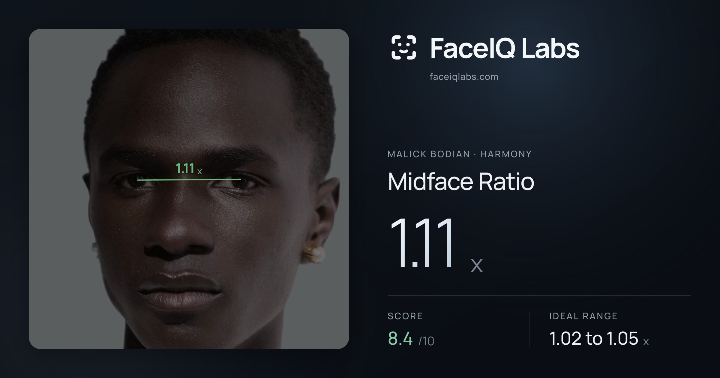 Malick Bodian Midface Ratio: 1.11x, drawn on the photo