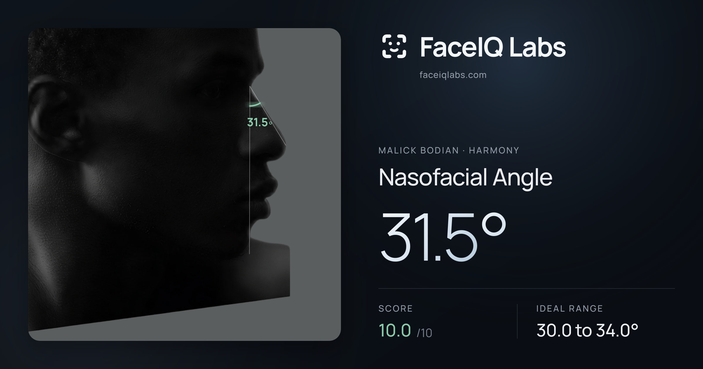 Malick Bodian Nasofacial Angle: 31.5°, drawn on the photo
