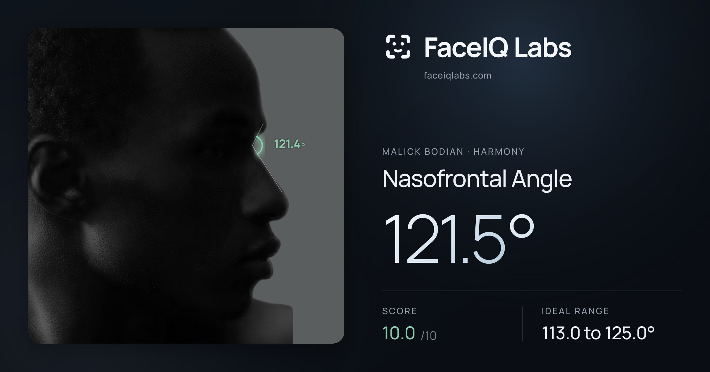 Malick Bodian Nasofrontal Angle: 121.5°, drawn on the photo