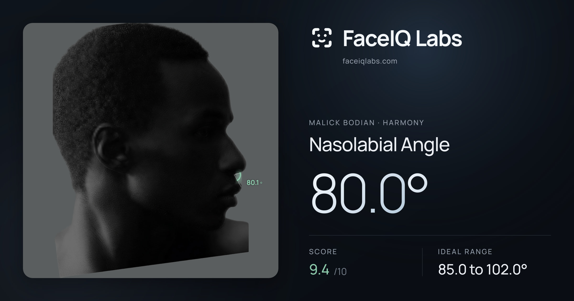 Malick Bodian Nasolabial Angle: 80.0°, drawn on the photo