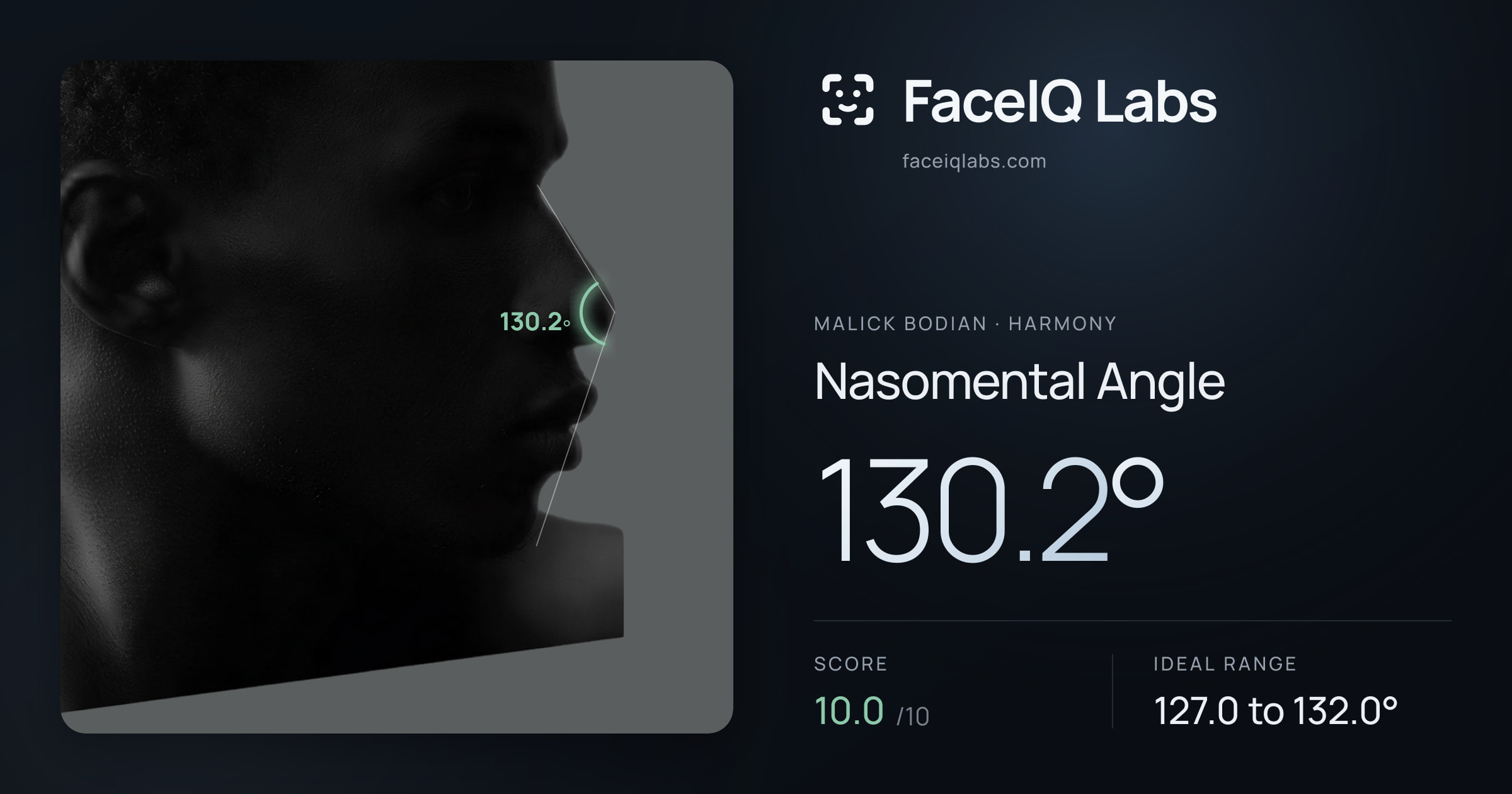 Malick Bodian Nasomental Angle: 130.2°, drawn on the photo