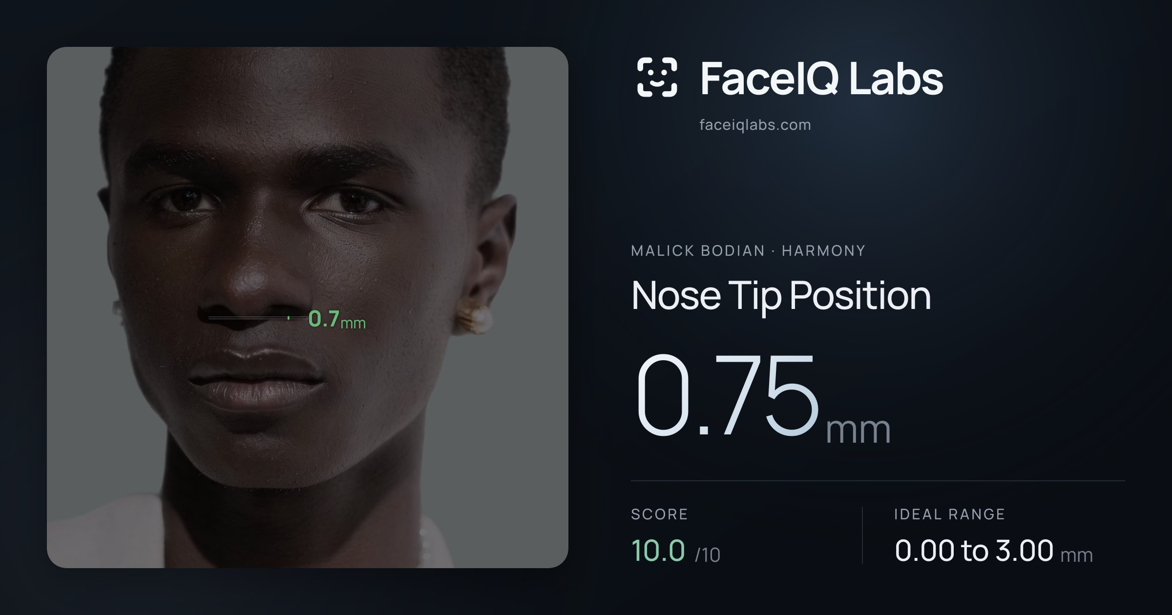 Malick Bodian Nose Tip Position: 0.75mm, drawn on the photo