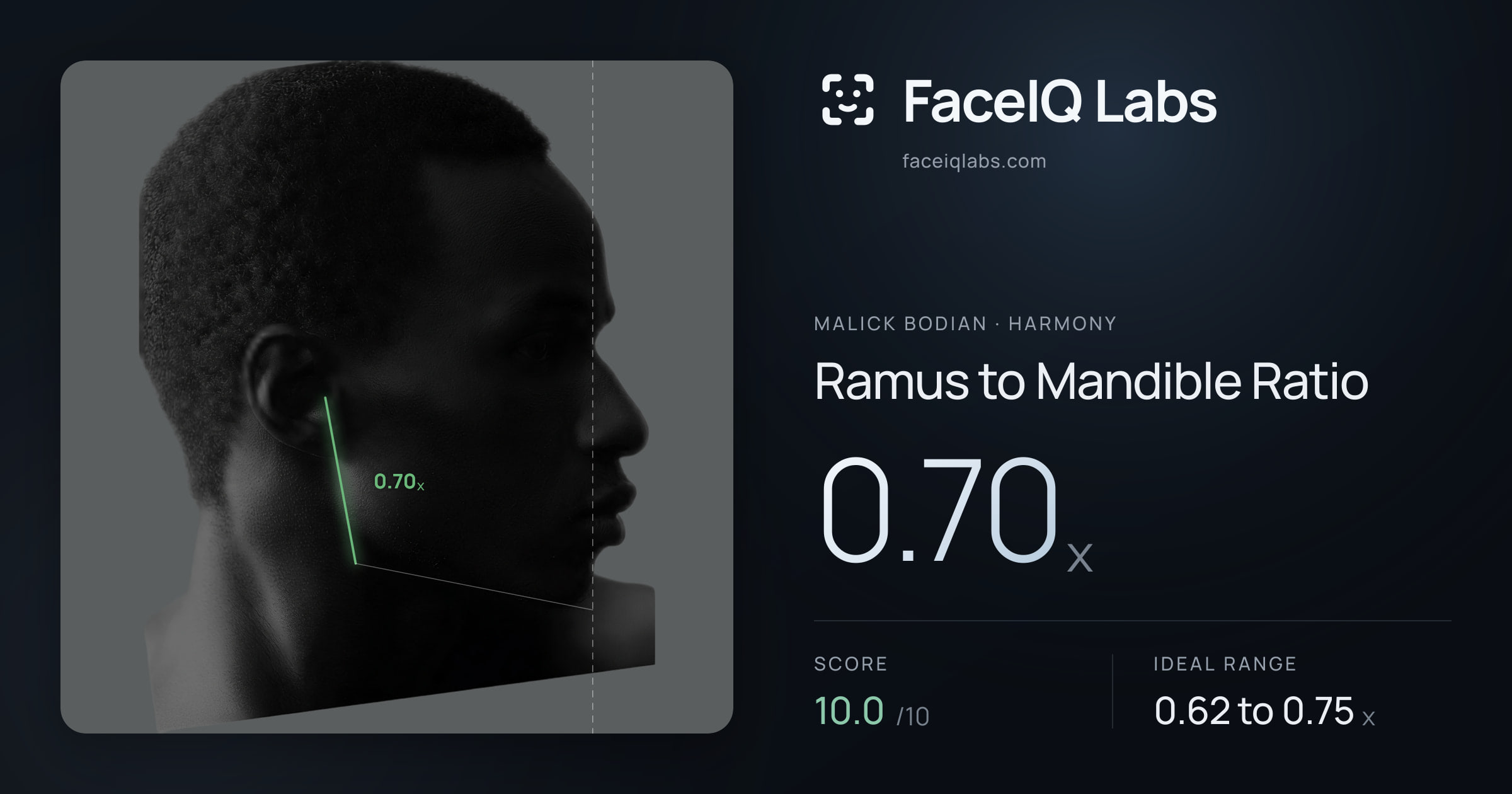 Malick Bodian Ramus to Mandible Ratio: 0.70x, drawn on the photo
