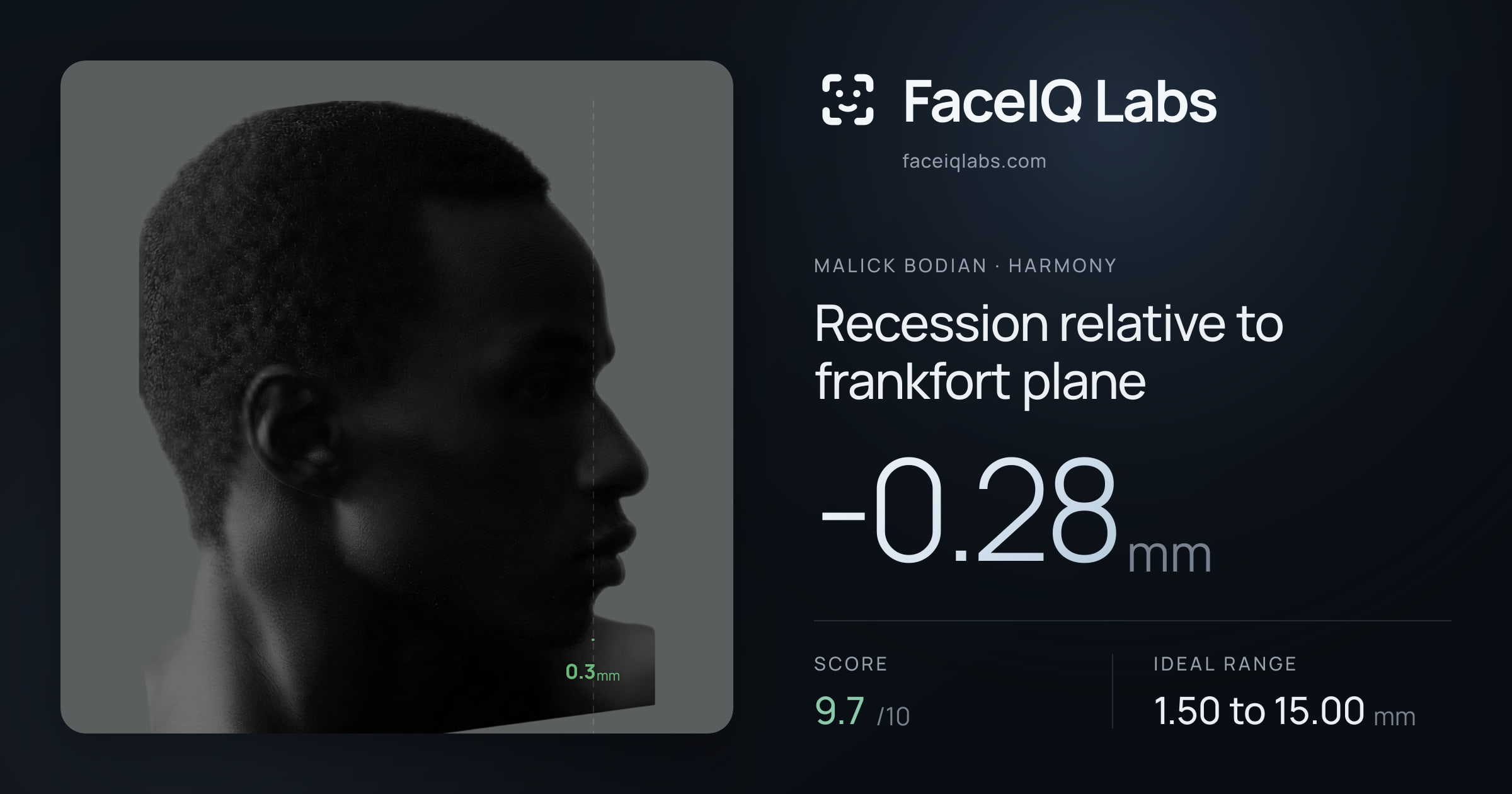 Malick Bodian Recession relative to frankfort plane: -0.28mm, drawn on the photo