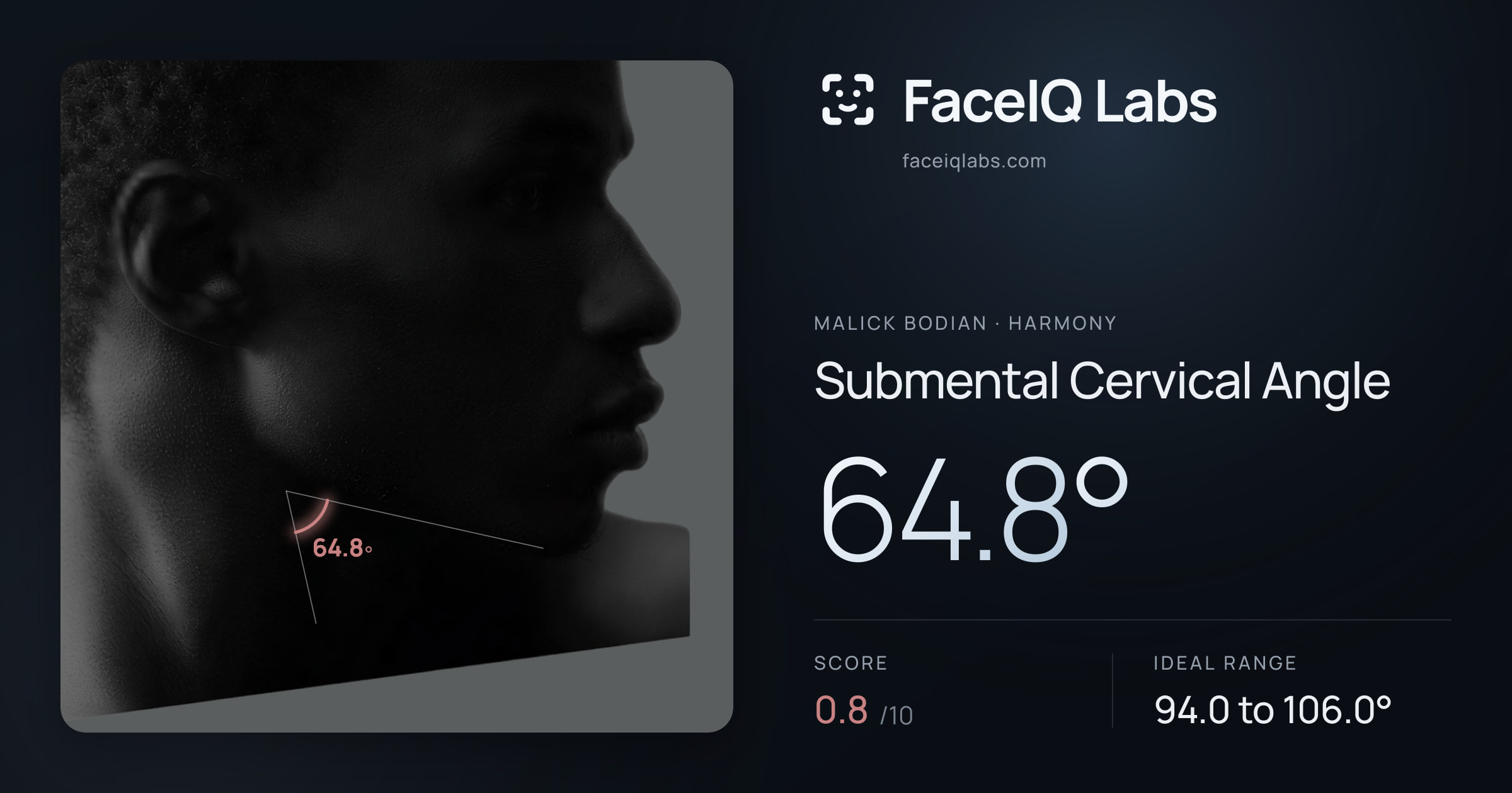 Malick Bodian Submental Cervical Angle: 64.8°, drawn on the photo