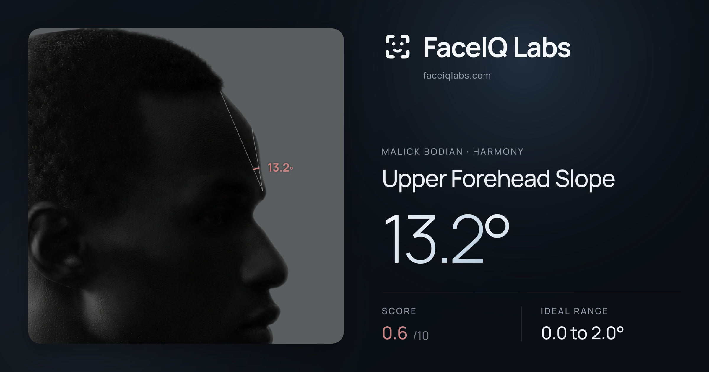 Malick Bodian Upper Forehead Slope: 13.2°, drawn on the photo