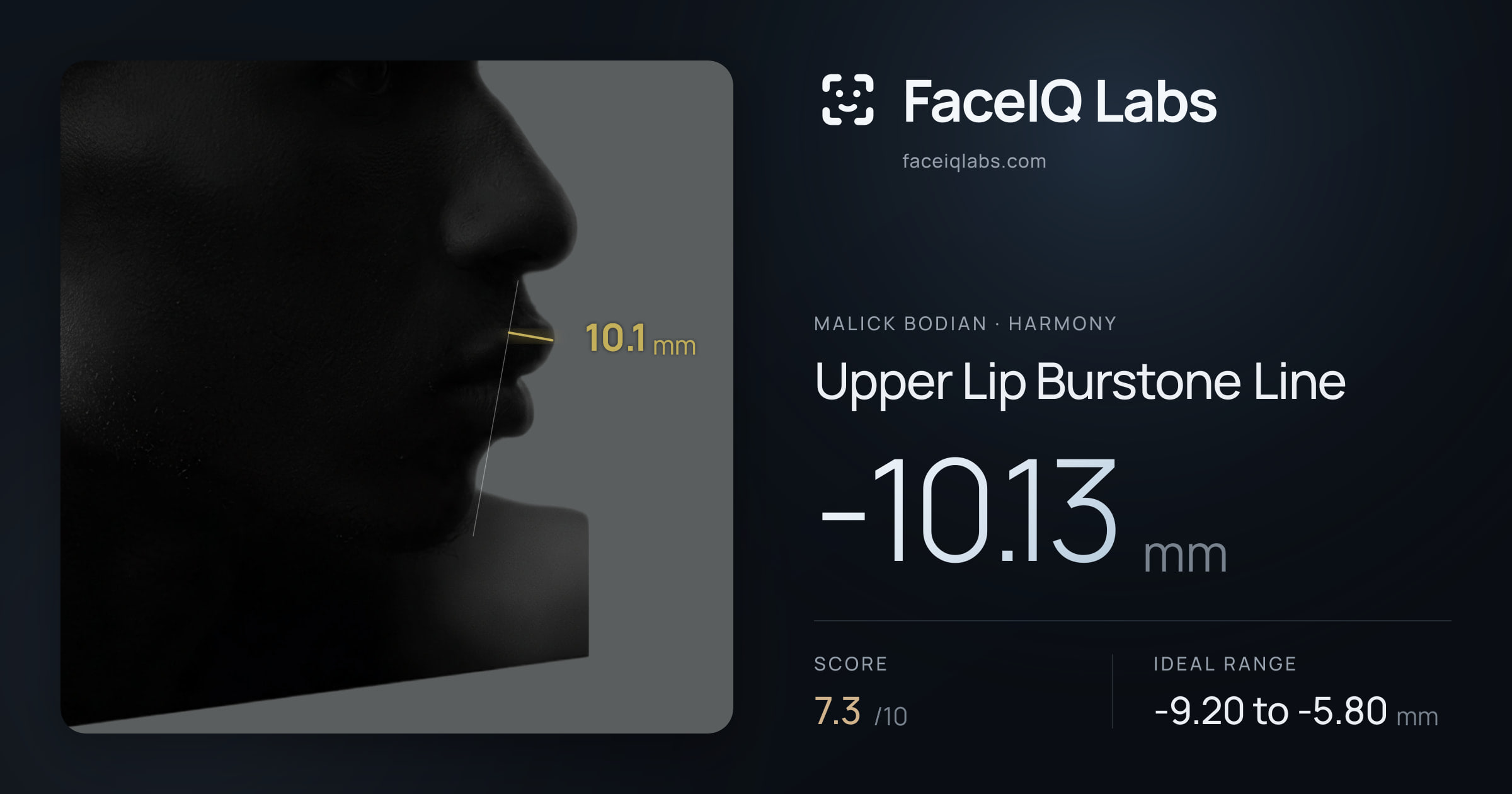 Malick Bodian Upper Lip Burstone Line: -10.13mm, drawn on the photo
