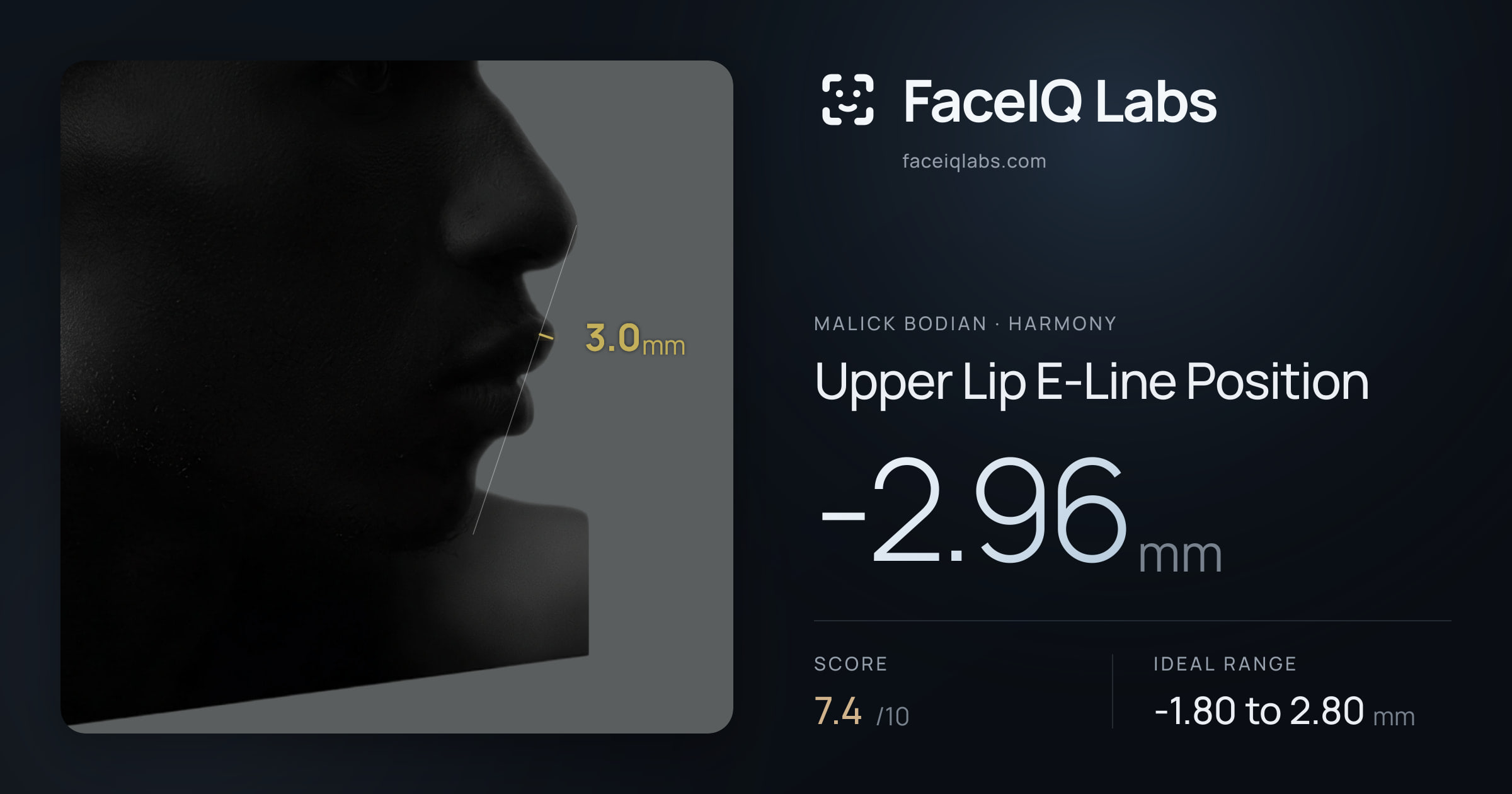 Malick Bodian Upper Lip E-Line Position: -2.96mm, drawn on the photo