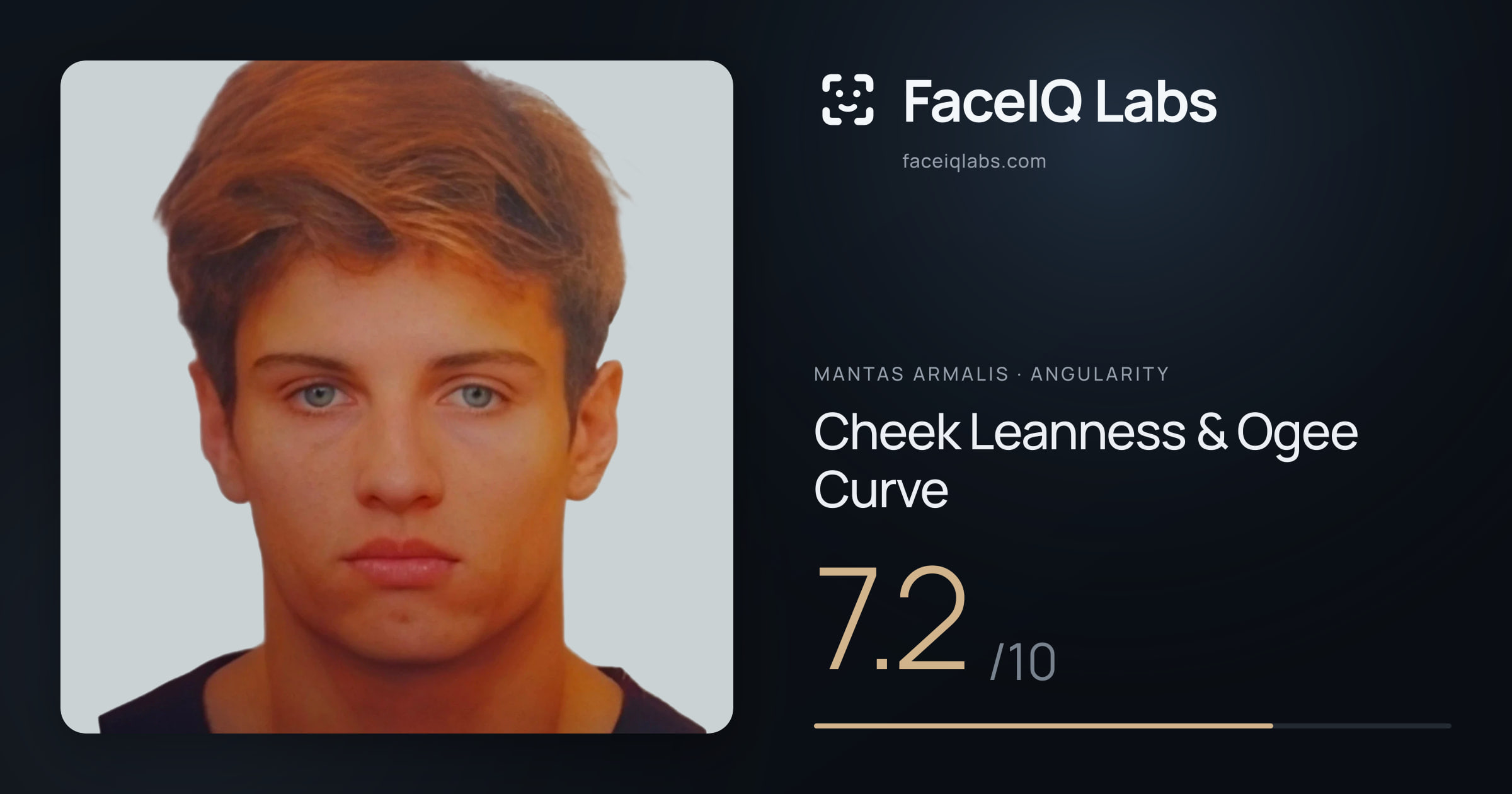 Mantas Armalis Cheek Leanness & Ogee Curve: 7.2/10, drawn on the photo