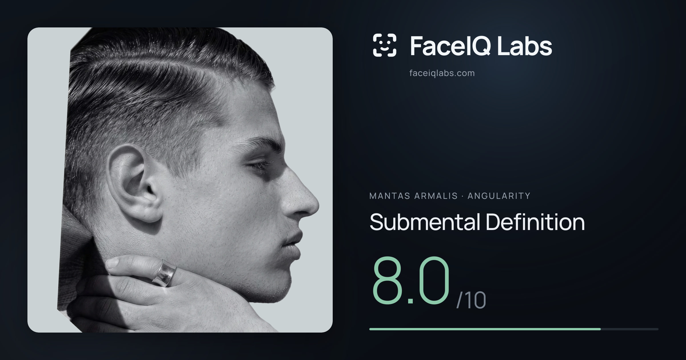 Mantas Armalis Submental Definition: 8.0/10, drawn on the photo