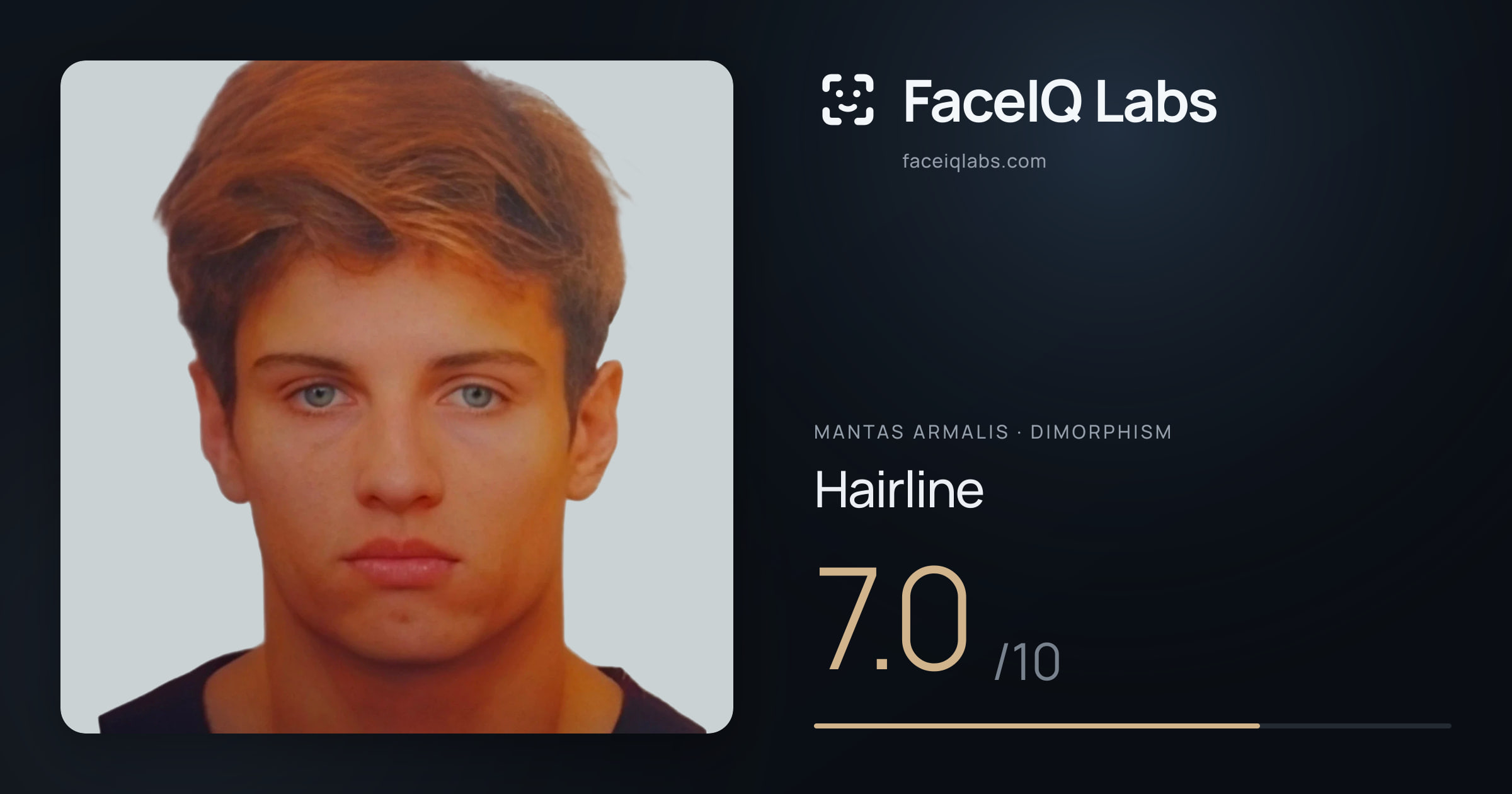 Mantas Armalis Hairline: 7.0/10, drawn on the photo