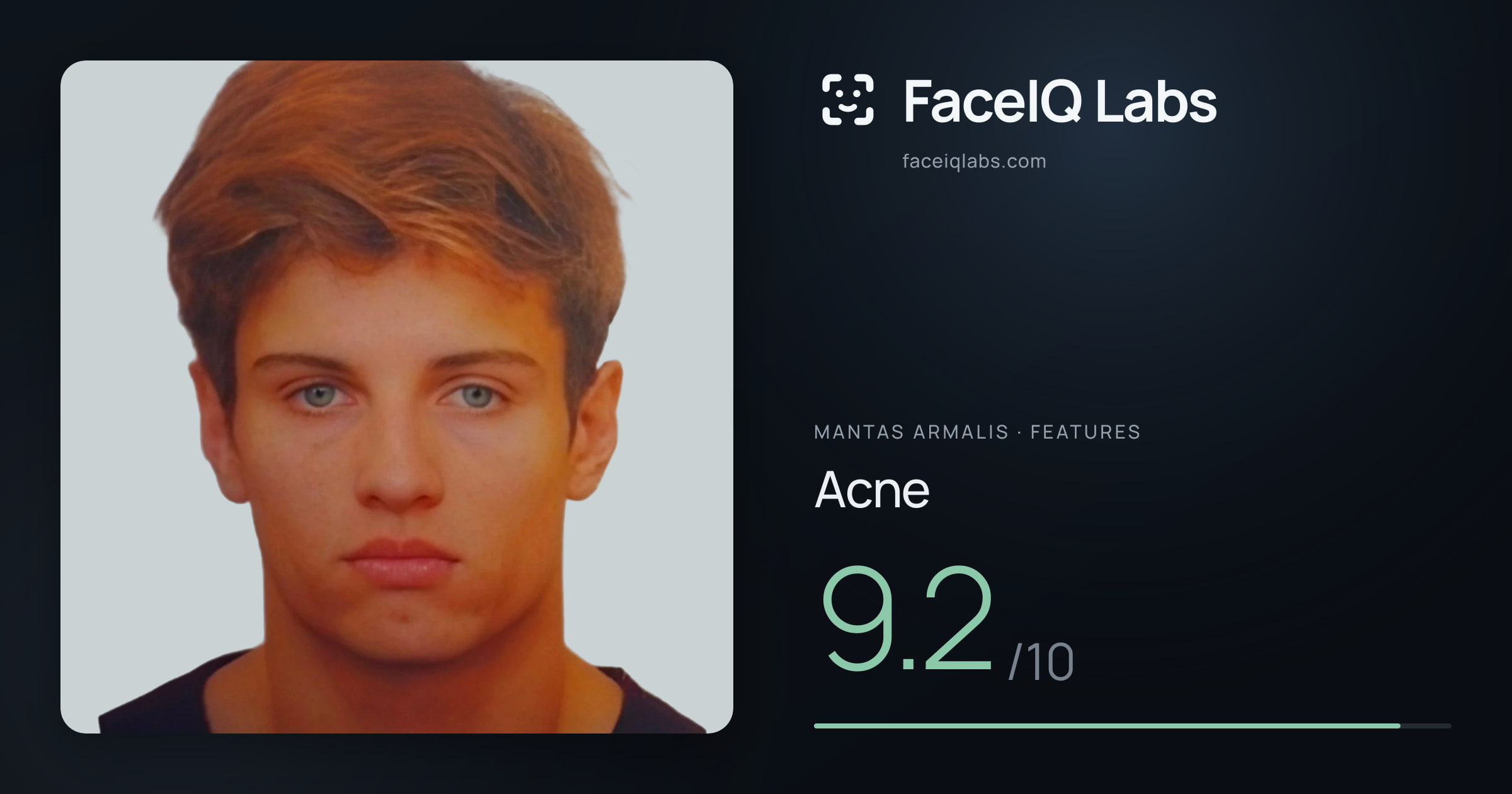 Mantas Armalis Acne: 9.2/10, drawn on the photo