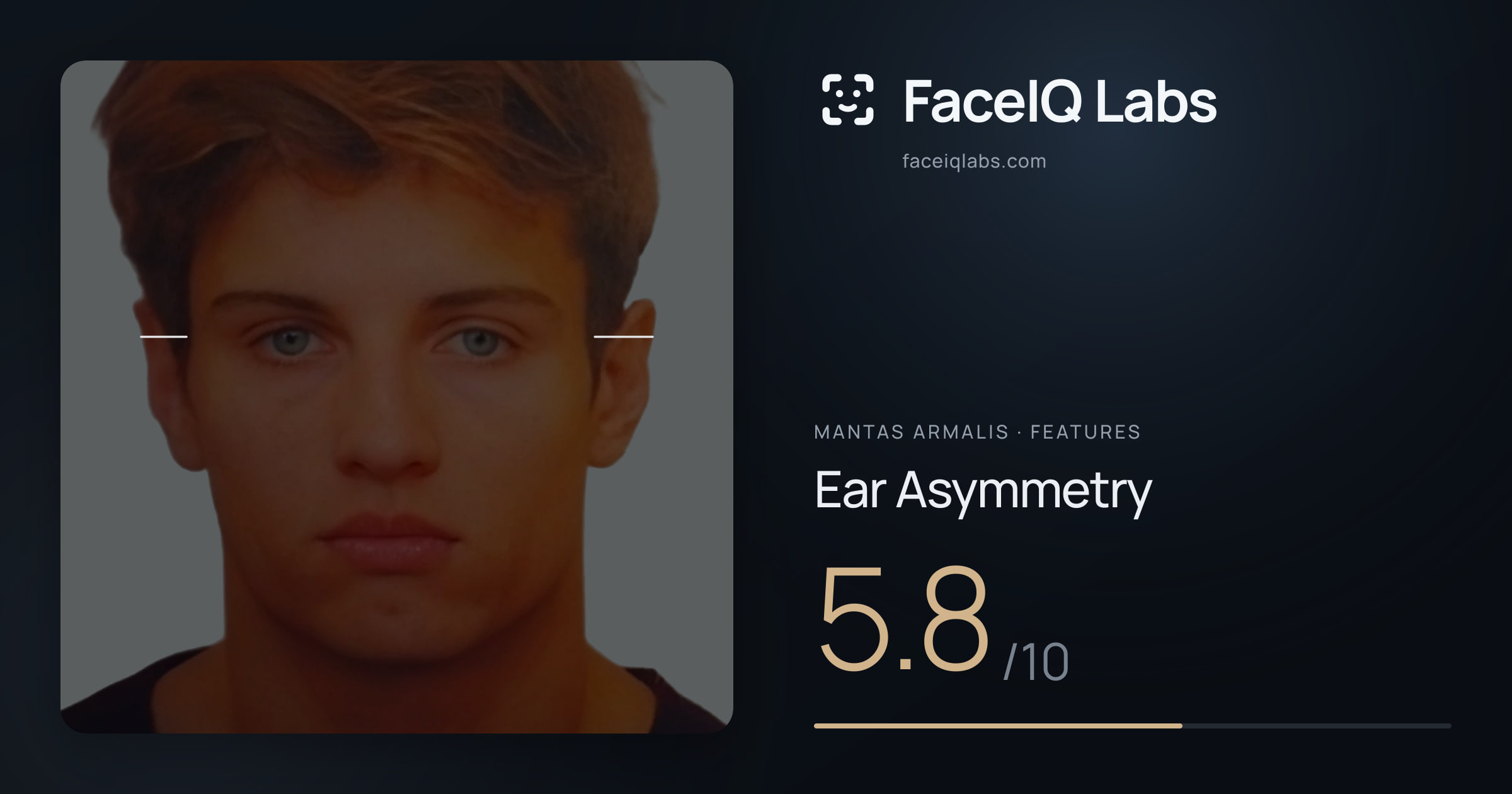 Mantas Armalis Ear Asymmetry: 5.8/10, drawn on the photo