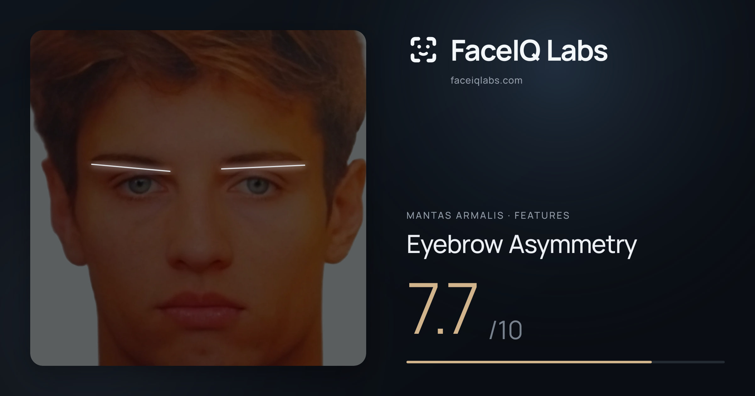 Mantas Armalis Eyebrow Asymmetry: 7.7/10, drawn on the photo