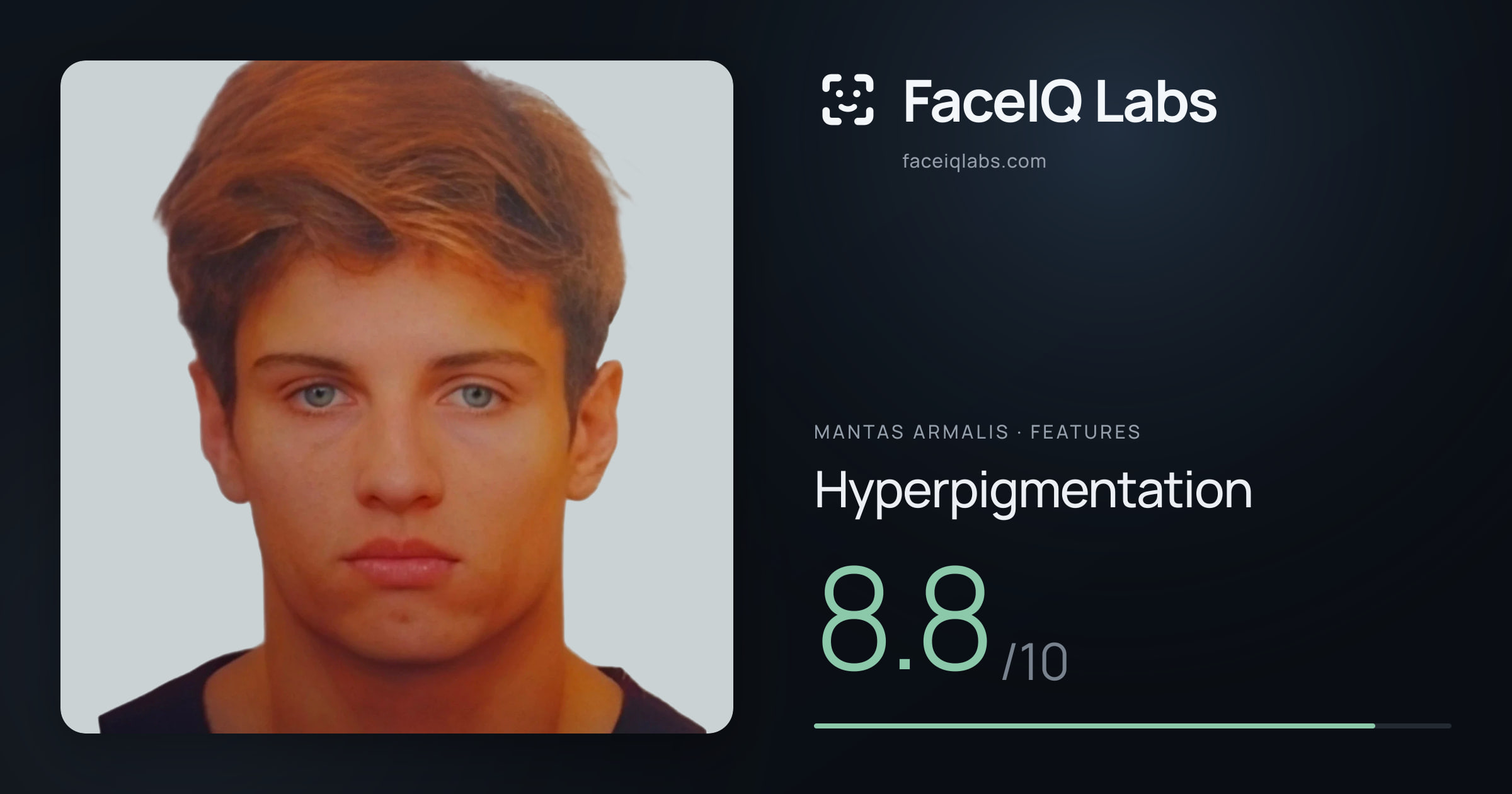 Mantas Armalis Hyperpigmentation: 8.8/10, drawn on the photo