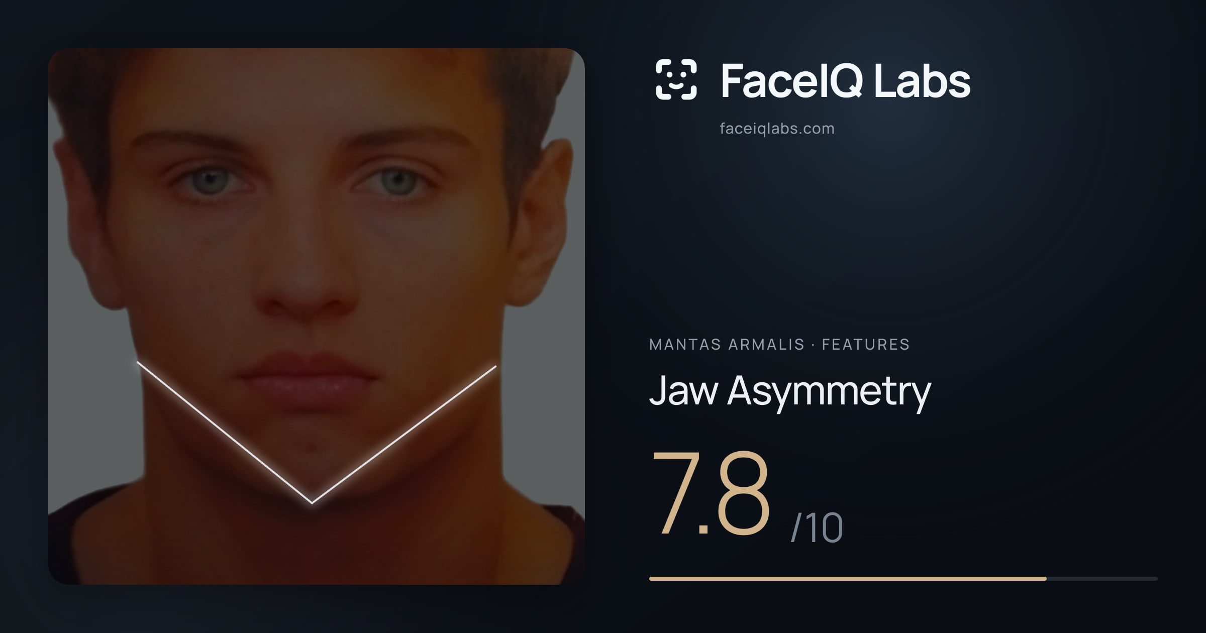 Mantas Armalis Jaw Asymmetry: 7.8/10, drawn on the photo