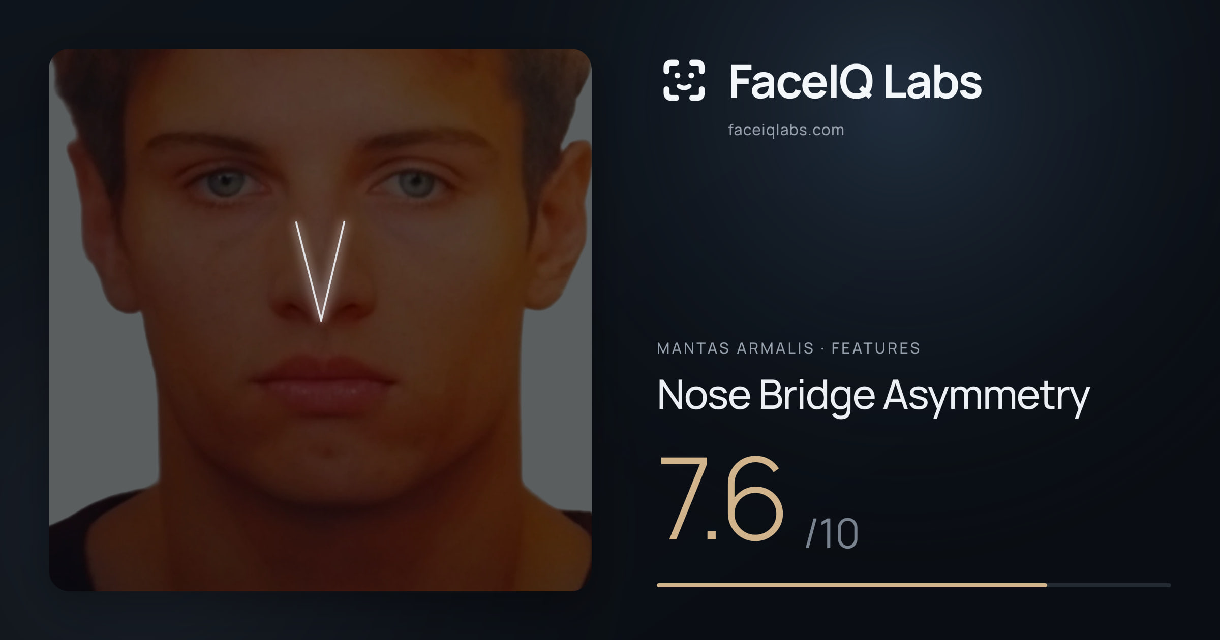 Mantas Armalis Nose Bridge Asymmetry: 7.6/10, drawn on the photo