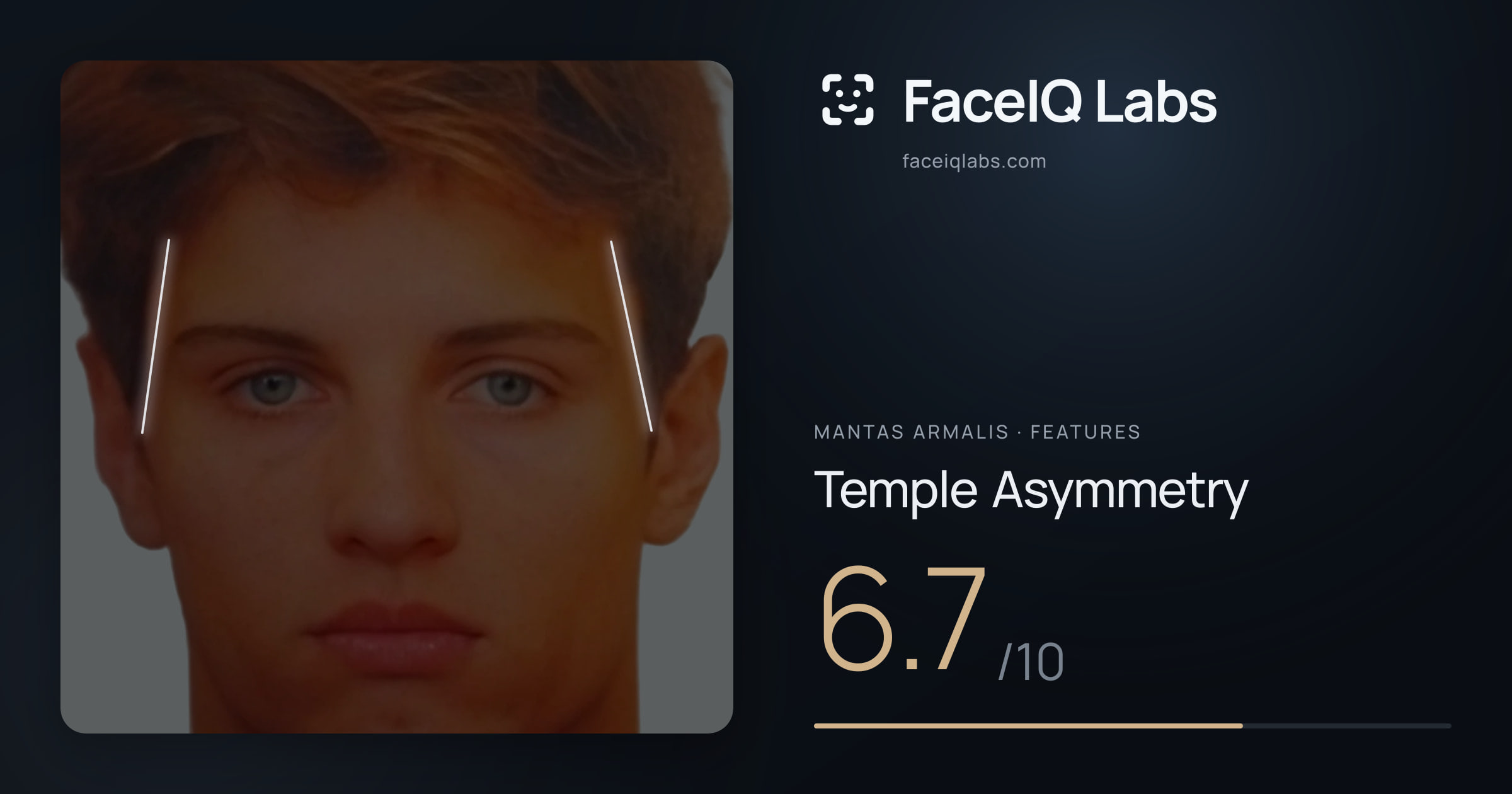 Mantas Armalis Temple Asymmetry: 6.7/10, drawn on the photo