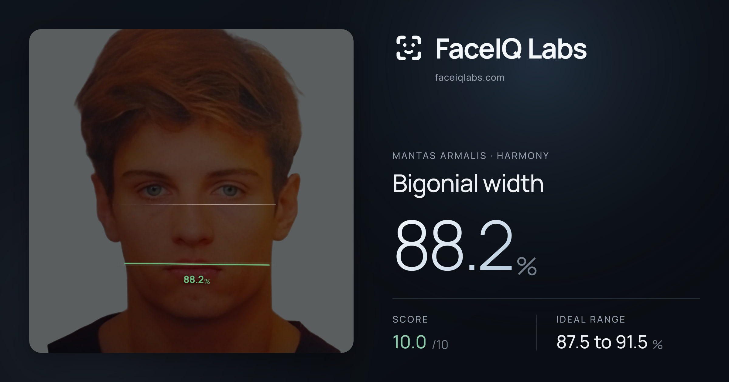 Mantas Armalis Bigonial width: 88.2%, drawn on the photo