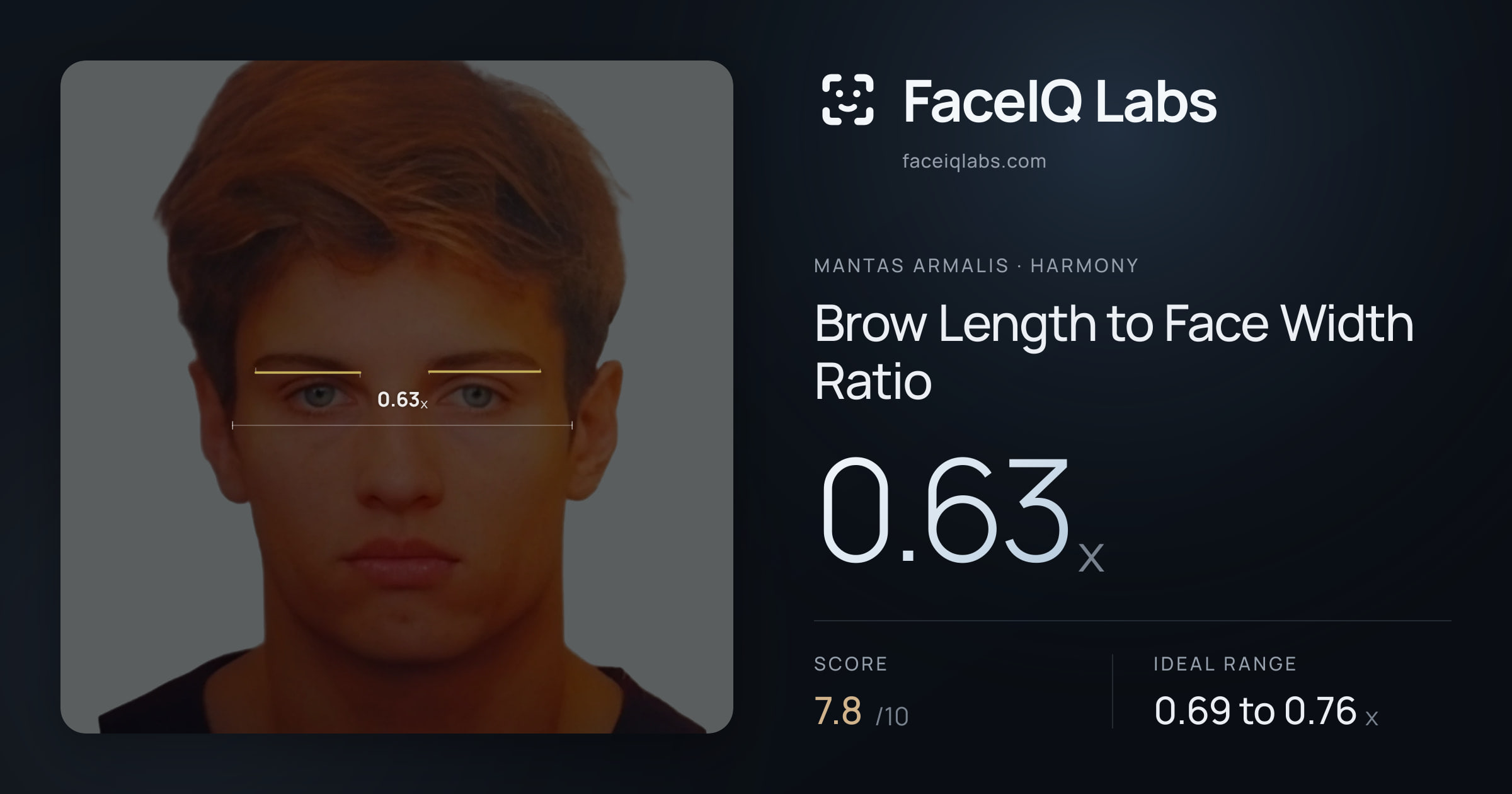 Mantas Armalis Brow Length to Face Width Ratio: 0.63x, drawn on the photo