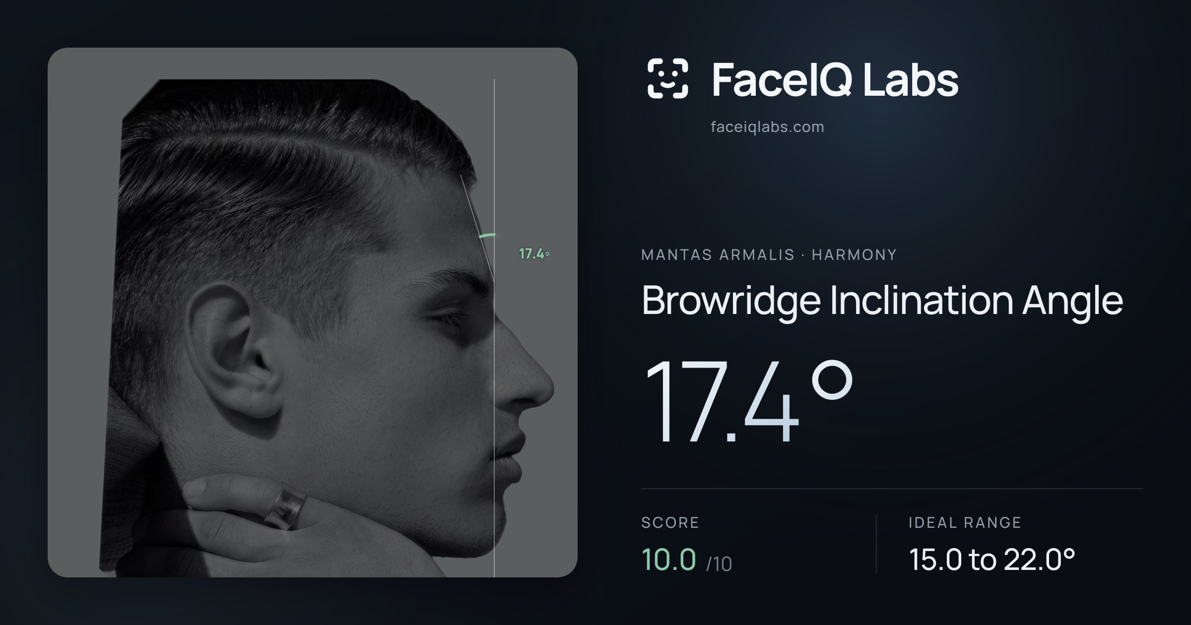 Mantas Armalis Browridge Inclination Angle: 17.4°, drawn on the photo